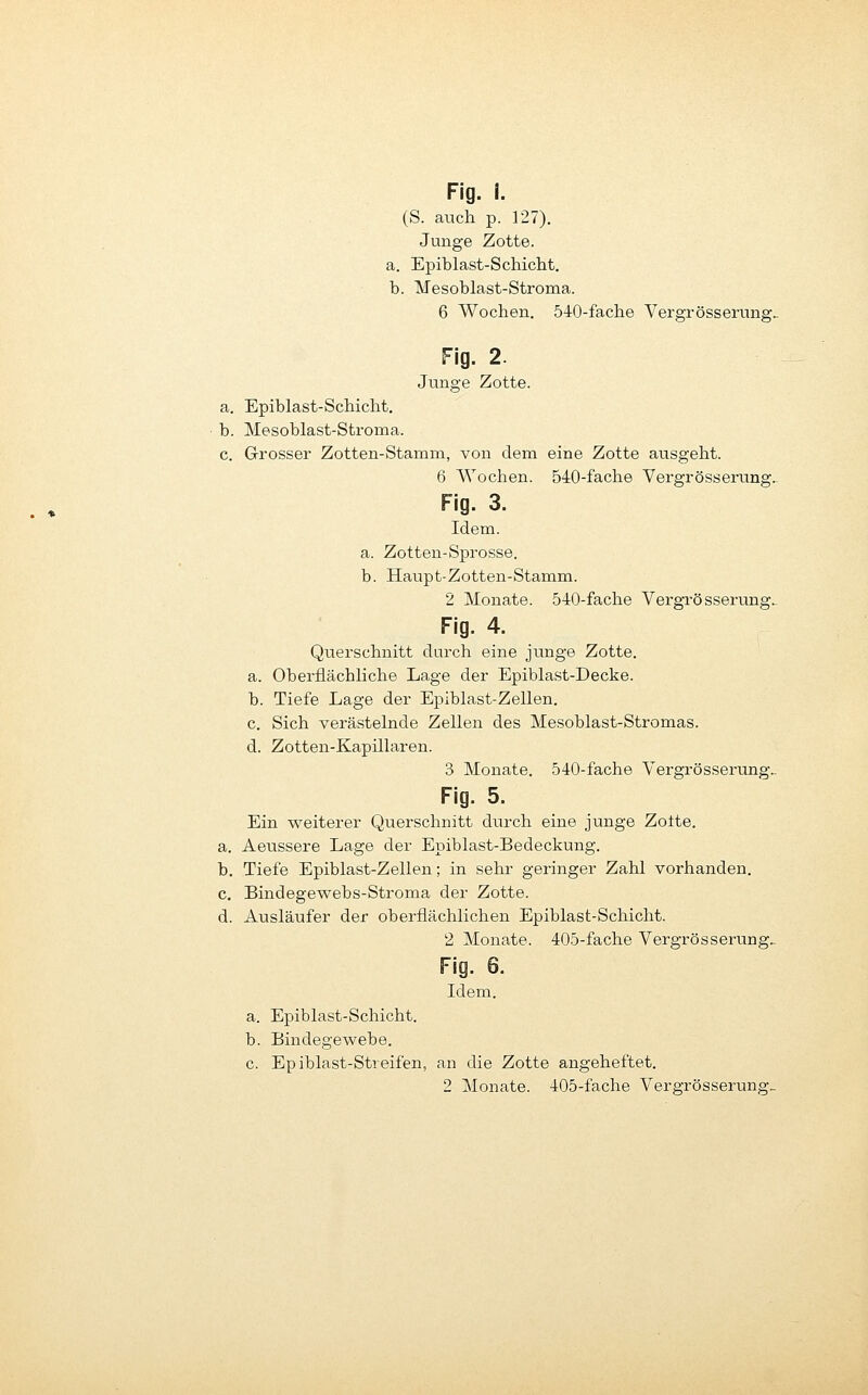 (S. auch p. 127). Junge Zotte. a. Epiblast-Schicht. b. Mesoblast-Stroma. 6 Wochen. 540-fache Vergrösserung.. Fig. 2. Junge Zotte. a. Epiblast-Schicht. b. Mesoblast-Stroma. c. Grosser Zotten-Stamm, von dem eine Zotte ausgeht. 6 Wochen. ÖiO-fache Vergrösserung. Fig. 3. Idem. a. Zotten-Sprosse. b. Haupt-Zotten-Stamm. 2 Monate. 540-fache Vergrösserung. Flg. 4. Querschnitt durch eine junge Zotte. a. Oberflächliche Lage der Epiblast-Decke. b. Tiefe Lage der Epiblast-Zellen. c. Sich verästelnde Zellen des Mesoblast-Stromas. d. Zotten-Kapillaren. 3 Monate. 540-fache Vergrösserung.. Flg. 5. Ein v^^eiterer Querschnitt durch eine junge Zolte. a. Aeussere Lage der Epiblast-Bedeckung. b. Tiefe Epiblast-Zellen; in sehr geringer Zahl vorhanden. c. Bindegewebs-Stroma der Zotte. d. Ausläufer der oberflächlichen Epiblast-Schicht. 2 Monate. 405-fache Vergrösserung.- Fig. 6. Idem. a. Epiblast-Schicht. b. Bindegev^ebe. c. Epiblast-Streifen, an die Zotte angeheftet. 2 Monate. 405-fache Vergrösserung»