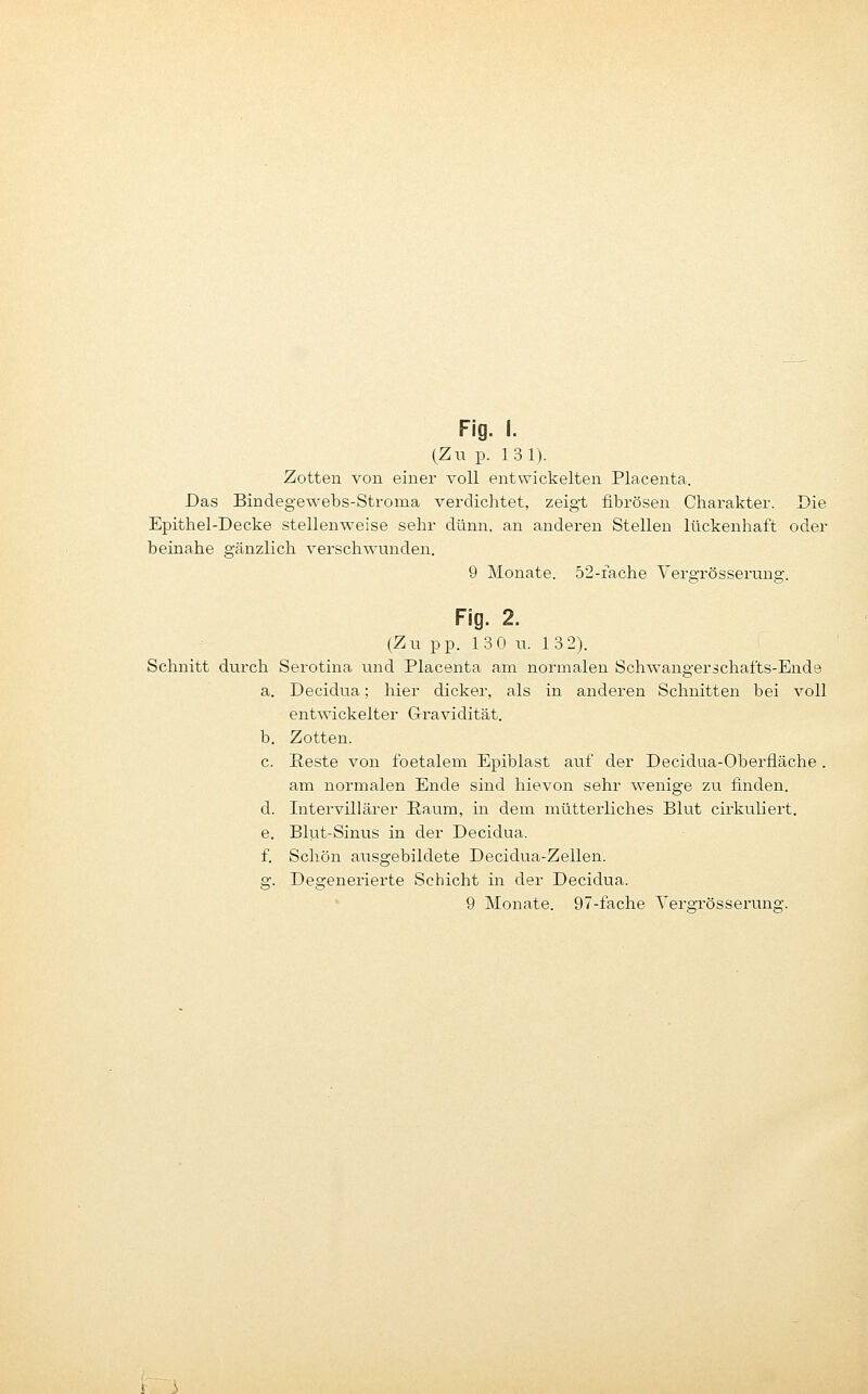 (Zu p. 13 1). Zotten von einer voll entwickelten Placenta. Das Bindegewebs-Stroma verdichtet, zeigt fibrösen Charakter. Die Epithel-Decke stellenweise sehr dünn, an anderen Stellen lückenhaft oder beinahe gänzlich verschwunden. 9 Monate. 52-iache Vergrösserung. Fig. 2. (Zu pp. 130 u. 13 2). Schnitt durch Serotina und Placenta am normalen Schwangerschafts-Ende a. Decidua; hier dicker, als in anderen Schnitten bei voll entwickelter G-ravidität. b. Zotten. c. Reste von foetalem Epiblast auf der Decidua-Oberfläche . am normalen Ende sind hievon sehr wenige zu finden. d. Intervillärer Raum, in dem mütterliches Blut cirkuliert. e. Blut-Sinus in der Decidua. f. Schön ausgebildete Decidua-Zellen. g. Degenerierte Schicht in der Decidua. 9 Monate. 97-fache Yergrösserung.