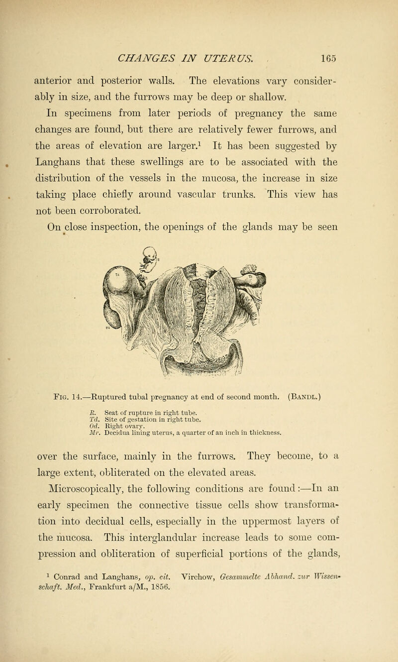 anterior and posterior walls. The elevations vary consider- ably in size, and the furrows may be deep or shallow. In specimens from later periods of pregnancy the same changes are found, but there are relatively fewer furrows, and the areas of elevation are larger.^ It has been suggested by Langhans that these swellings are to be associated with the distribution of the vessels in the mucosa, the increase in size taking place chiefly around vascular trunks. This view has not been corroborated. On close inspection, the openings of the glands may be seen Fig. 14.—Ruptured tubal pregnancy at end of second month. (Baxdl.) -R. Seat of rupture in right tube. Td. Site of gestation in riglit tube. Od. Right ovary. Mr. Decidua lining uterus, a quarter of an incli in tliiclcness. over the surface, mainly in the furrows. They become, to a large extent, obliterated on the elevated areas. Microscopically, the following conditions are found:—In an early specimen the connective tissue cells show transforma- tion into decidual cells, especially in the uppermost layers of the mucosa. This intero;landular increase leads to some com- pression and obliteration of superj&cial portions of the glands, ^ Conrad and Langhans, op. eit. Virchow, Gesammcltc Ahhand. zur Wissen- schaft. Med., Frankfurt a/M., 1856.