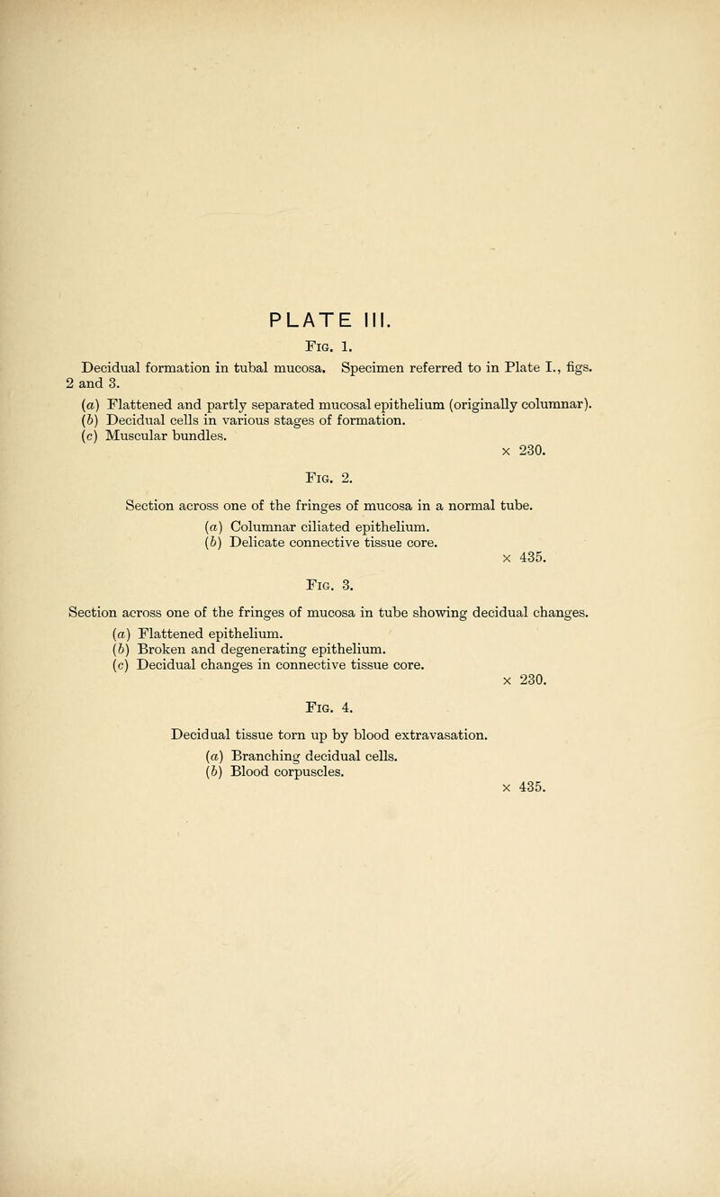 Fig. 1, Decidual formation in tubal mucosa. Specimen referred to in Plate I., figs. 2 and 3. (a) Flattened and partly separated mucosal epithelium (originally columnar). (&) Decidual cells in various stages of formation, (c) Muscular bundles. X 230. Fig. 2. Section across one of the fringes of mucosa in a normal tube. (a) Columnar ciliated epithelium. (b) Delicate connective tissue core. X 435. Fig. 3. Section across one of the fringes of mucosa in tube showing decidual changes. (a) Flattened epithelium. (b) Broken and degenerating epithelium. (c) Decidual changes in connective tissue core. X 230. Fig. 4. Decidual tissue torn up by blood extravasation. (a) Branching decidual cells. (b) Blood corpuscles. X 435.