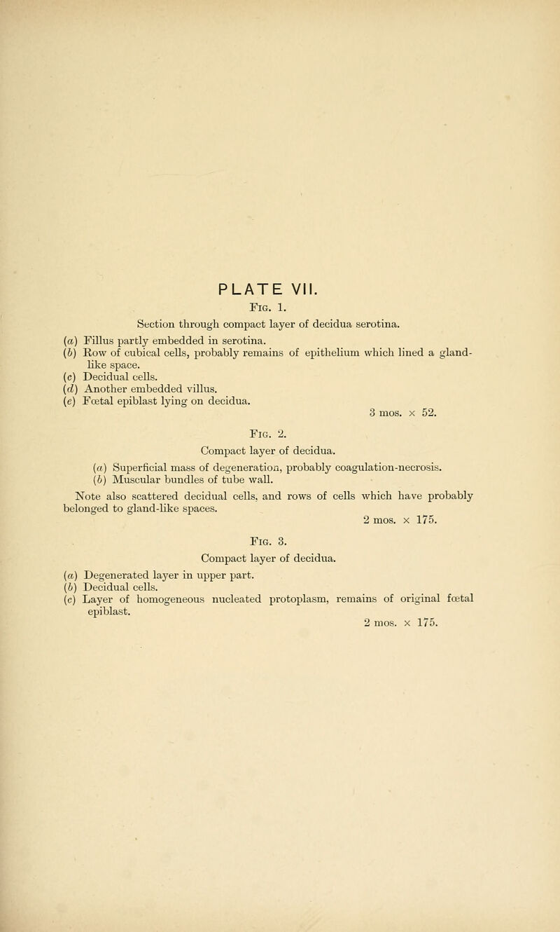 Tig. 1. Section through compact layer of decidua serotina. (a) Fillus partly embedded m serotina. (6) Row of cubical cells, probably remains of epithelium which lined a gland- like space. (c) Decidual cells. (d) Another embedded villus. (e) Fcetal epiblast lying on decidua. 3 mos. X 52. Fig. 2. Compact layer of decidua. (rt) Superficial mass of degeneration, probably coagulation-necrosis. (6) Muscular bundles of tube wall. Note also scattered decidual cells, and rows of cells which have probably belonged to gland-like spaces. 2 mos. X 175. Fig. 3. Compact layer of decidua. (a) Degenerated laj^er in upper part. (b) Decidual cells. (c) Layer of homogeneous nucleated protoplasm, remains of original foital epiblast.