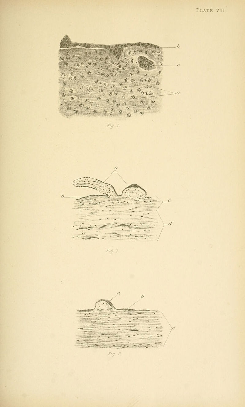 -1 ^ Fy Plate viii Fig