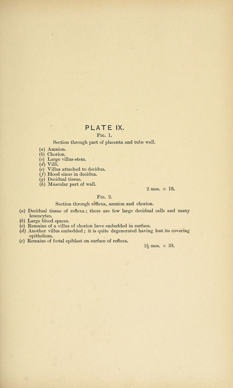 Fig. 1, Section through part of placenta and tube wall. (a) Amnion. (6) Chorion. (c) Large villus-stem. (d) Villi. (e) Villus attached to decidua. (/) Blood sinus in decidua. (g) Decidual tissue. (h) Muscular part of wall. 2 mos. X 10. Fig. 2. Section through rfeflexa, amnion and chorion. (a) Decidual tissue of reflexa; there are few large decidual cells and many leucocytes. (6) Large blood spaces. (c) Remains of a villus of chorion laeve embedded in surface. (d) Another villus embedded ; it is quite degenerated having lost its covering epithelium. (e) Remains of foetal epiblast on surface of reflexa. 2h mos. X 38.