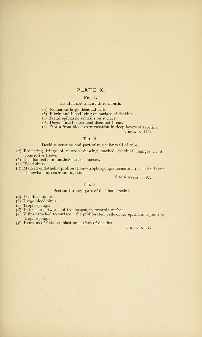 Fig. 1. Decidua serotina at third month. {a) Numerous large decidual cells. (b) Fibrin and blood lying on surface of decidua. (c) Foetal epiblastic remains on surface. (d) Degenerated superficial decidual tissue. (e) Fibrin from blood extravasation in deep layers of serotina. 3 mos. X 175. Fig. 2. Decidua serotina and part of muscular wall of tube. (a) Projecting fringe of mucosa showing marked decidual changes in its connective tissue. (&) Decidual cells in another part of mucosa. (c) Blood sinus. (d) Marked endothelial proliferation—trophospongia formation ; it extends out somewhat into surrounding tissue. 5 to 6 weeks x 97. FiG. 3. Section through part of decidua serotina. (a) Decidual tissue. (b) Large blood sinus. (c) Trophospongia. {d) Extension outwards of trophospongia towards surface. (e) Villus attached to surface ; the proliferated cells of its epithelium join the trophospongia. (/) Remains of foetal epiblast on surface of decidua. 3 mos. X 97.