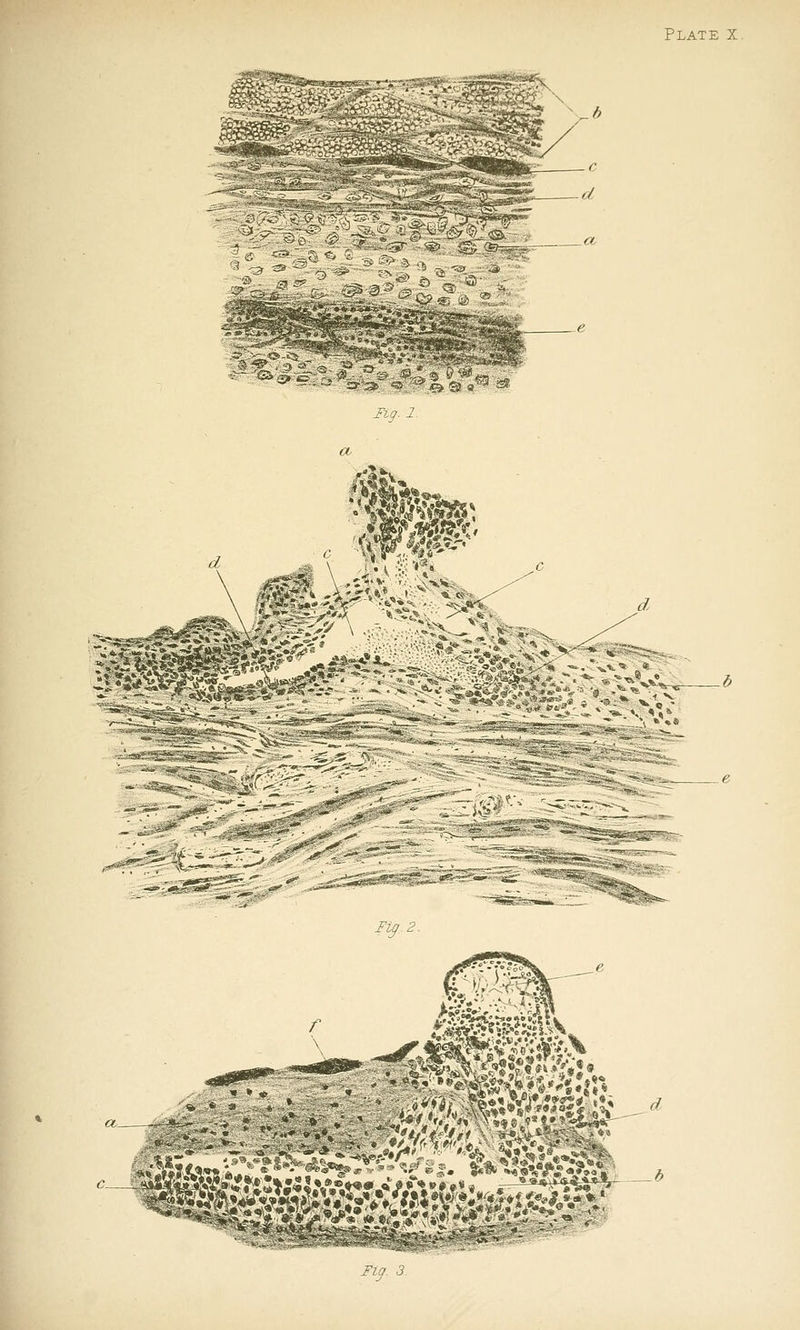 ll^-^^ *r> ® a Jly. J.