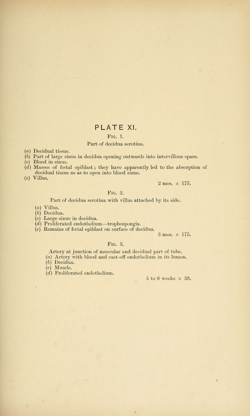 Fig. 1. Part of decidua serotina. (a) Decidual tissue. (6) Part of large sinus in decidua opening outwards into intervillous space. (c) Blood in sinus. {d) Masses of fcetal epiblast; they have apparently led to the absorption of decidual tissue so as to open into blood sinus, (e) Villus. 2 mos. X 175. Fig. 2. Part of decidua serotina with villus attached by its side. (a) Villus. (&) Decidua. (c) Large sinus in decidua. (d) Proliferated endothelium—trophospongia. (e) Remains of foetal epiblast on surface of decidua. 3 mos. X 175. Fig. 3. Artery at junction of muscular and decidual part of tube, (rt) Artery with blood and cast-off endothelium in its lumen. (6) Decidua. (c) Muscle. [d) Proliferated endothelium.
