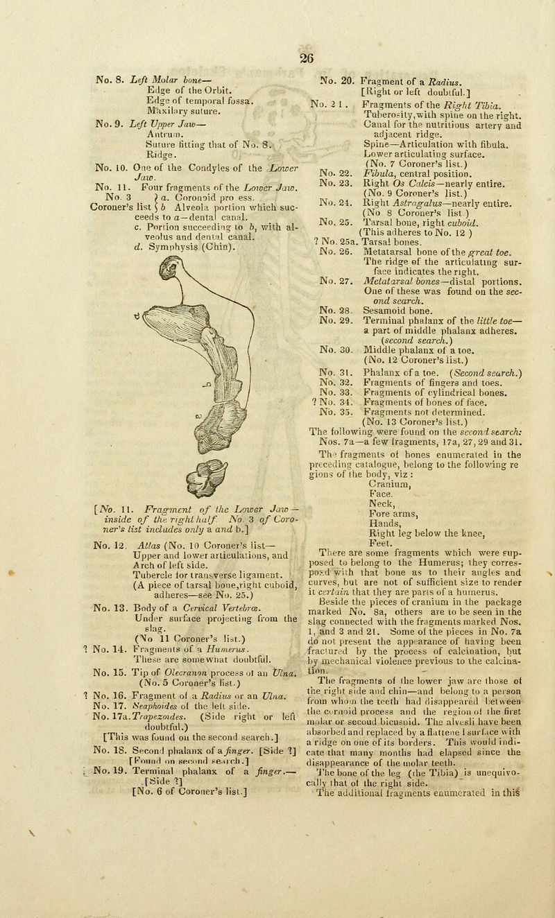 36 No. 8. Lift Molar lone— Edge of the Orbit. Edge of temporal fossa. Maxiliiry suture. No. 9. Left Upper Jaw— Antrum. Suture fitting that of No, 8. Ridge. No. 10. One of the Condyles of the Lmeer Jaio. No. 11. Four fragments of the Loioer Jaw. No. 3 )a. Coronoid pro ess. Coroner's list ^ b Alveola portion which suc- ceeds to a—dental canal. c. Portion succeeding to b, with al- veolus and denwl canal. d. Symphysis (Chin). [No. 11. Fragment of the Lower Jaw — inside of the right tcalf. No. 3 of Coro- ner's list indades only a and b.] No. 12. Atlas (No. 10 Coroner's list- Upper and lower arliculaiions, and Archof left side. Tubercle lor transverse ligament. ' (A piece of tarsal bone,right cuboid, adheres—see No. 25.) No. 13. Body of a Cervical Vertebrce. Under surface projecting from the slag. (No '^11 Coroner's list.) No. 14. F'ragments of a Humerics. These are somewhat doubtful. No. 15. Tip of Olecranon proce.ss ut an Ulna. (No. 5 Coroner's list.) No. 16. Fragment of a Radius or an Ulaa. No. 17. Seaphoides ot the led side. No. lla..Trapezoides. (Side right or left doubtful.) [This was found on the second search.] No. IS. Second phalanx of&Jinger. [Side 1] [Found on second Fe.uch.] No. 19. Terminal phalanx of a finger [Side 1] [No. 6 of Coroner's list.] No. 20. Fragment of a Radius. [Right or left doubtful.] No. 3 1. Fragments of the Right Tibia. Tuberosily,with spine on the right. Canal for the nutritious artery and adjacent ridge. Spine—Articulation with fibula. Lower articulating surface. (No. 7 Coroner's list.) No. 22. Fibula, central position. No. 23. Right Os CaZcis—nearly entire. (No. 9 Coroner's list.) No, 24. Right Astragalus—nearly entire. (No 8 Coroner's list.) No. 25. Tarsal bone, right cuboid. (This adheres to No. 12 ) ? No. 25a. Tarsal bones. No. 26. Metatarsal bone of the ^^^reai toe. The ridge of the articulating sur- face indicates the right. No. 27. Metatarsal bones—distal portions. One of these was found on the sec- ond search. No. 28. Sesamoid bone. No. 29. Terminal phalanx of the little toe— a part of middle phalanx adheres. (second search.) No. 30. Middle phalanx of a toe. (No. 12 Coroner's list.) No. 31. Phalanx of a toe. (Second search.) No, 32. Fragments of fingers and toes. No. 33, Fragments of cylindrical bones. ? No. 31. Fragments of bones efface. No. 35. Fragments not determined. (No. 13 Coroner's list.) The following were found on the second search; Nos. 7a—a few iragments, 17a, 27,29 and 31. The fragments oi bones enumerated in the preceding catalogue, belong to the following re gions of the body, viz : Cranium, Face. Neck, Fore arms, Hands, Right leg below the knee, Feet. There are some fragments which were Eup- posed to belong to the Humerus; ihey eorres- poid with that bone as to their angles and curves, but are not of sufficient size to render it certain that they are parts of a humerus. Beside the pieces of cranium in the package marked No. 8a, others are to be seen in the slag connected with the fragments marked Nos. 1, and 3 and 21. Some ot the pieces in No. 7a do not present the appearance of having been fractured by the process of calcination, but by mechanical violence previous to the calcina- tion. The fragments o( ihe lower jaw are those ot the right side and chin—and belong to a peison from whom the teeth had disappeared i;et«een the curnoid process and the region oi the first molar or second bicuspid. The alvusli have been absorbed and replaced by a flattene 1 surl.ice with a ridge on one of its borders. This would indi- cate that many months had elapsed since the disappearance of the molar teeth, 'J'he bone of the leg (the Tibia) is unequivo- cally ihat ol the right side. The additional Iragments enumerated in this