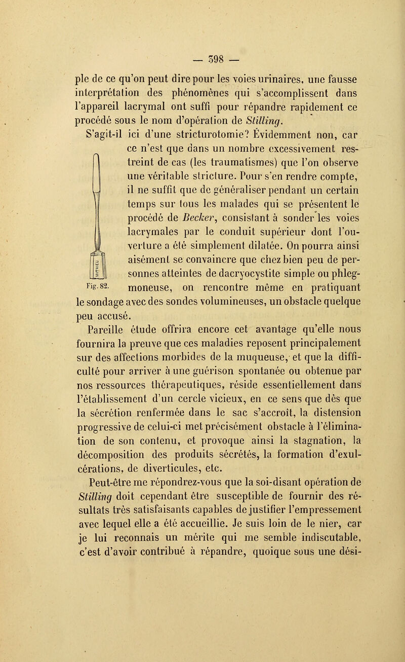 pie de ce qu'on peut dire pour les voies urinaires, une fausse interprétation des phénomènes qui s'accomplissent dans l'appareil lacrymal ont suffi pour répandre rapidement ce procédé sous le nom d'opéralion de Stilling. S'agit-il ici d'une stricturotomie? Évidemment non, car ce n'est que dans un nombre excessivement res- treint de cas (les traumatismes) que l'on observe une véritable striclure. Pour s'en rendre compte, il ne suffit que de généraliser pendant un certain temps sur tous les malades qui se présentent le procédé de Becker, consistant à sonder les voies lacrymales par le conduit supérieur dont l'ou- verture a été simplement dilatée. On pourra ainsi aisément se convaincre que chez bien peu de per- sonnes atteintes de dacryocystite simple ou phleg- Fig.82. moneuse, on rencontre même en pratiquant le sondage avec des sondes volumineuses, un obstacle quelque peu accusé. Pareille étude offrira encore cet avantage qu'elle nous fournira la preuve que ces maladies reposent principalement sur des affections morbides de la muqueuse, et que la diffi- culté pour arriver à une guérison spontanée ou obtenue par nos ressources thérapeutiques, réside essentiellement dans l'établissement d'un cercle vicieux, en ce sens que dès que la sécrétion renfermée dans le sac s'accroît, la distension progressive de celui-ci met précisément obstacle à l'élimina- tion de son contenu, et provoque ainsi la stagnation, la décomposition des produits sécrétés, la formation d'exul- cérations, de diverticules, etc. Peut-être me répondrez-vous que la soi-disant opération de Stilling doit cependant être susceptible de fournir des ré- sultats très satisfaisants capables de justifier l'empressement avec lequel elle a été accueillie. Je suis loin de le nier, car je lui reconnais un mérite qui me semble indiscutable, c'est d'avoir contribué à répandre, quoique sous une dési-