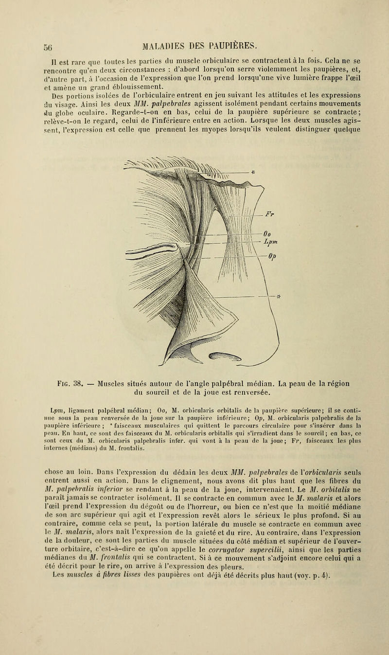 5<j Il est rare que toutes les parties du muscle orbiculaire se contractent à la fois. Cela ne se rencontre qu'en deux circonstances : d'abord lorsqu'on serre violemment les paupières, et, d'autre part, à l'occasion de l'expression que l'on prend lorsqu'une vive lumière frappe l'œil et amène un grand éblouissement. Des portions isolées de l'orbiculaire entrent en jeu suivant les attitudes et les expressions du visage. Ainsi les deux MM. palpebrales agissent isolément pendant certains mouvements du globe oculaire. Regarde-t-on en bas, celui de la paupière supérieure se contracte; relève-t-on le regard, celui de l'inférieure entre en action. Lorsque les deux muscles agis- sent, l'expression est celle que prennent les myopes lorsqu'ils veulent distinguer quelque Fig. 38. — Muscles situés autour de l'angle palpébral médian. La peau de la région du sourcil et de la joue est renversée. Lpm, ligament palpébral médian; Oo, M. orbicularis orbitalis de la paupière supérieure; il se conti- nue sous la peau renversée de la joue sur la paupière inférieure; Op, M. orbicularis palpebralis de la paupière inférieure ; * faisceaux musculaires qui quittent le parcours circulaire pour s'insérer dans la peau. En haut, ce sont des faisceaux du M. orbicularis orbitalis qui s'irradient dans le sourcil; en bas, ce sont ceux du M. orbicularis palpebralis infer. qui vont à la peau de la joue; F?', faisceaux les plus internes (médians) du M. frontalis. chose au loin. Dans l'expression du dédain les deux MM. palpebrales de Y orbicularis seuls entrent aussi en action. Dans le clignement, nous avons dit plus haut que les fibres du M. palpebralis inferior se rendant à la peau de la joue, intervenaient. Le M. orbitalis ne paraît jamais se contracter isolément. Il se contracte en commun avec le M. malaris et alors l'œil prend l'expression du dégoût ou de l'horreur, ou bien ce n'est que la moitié médiane de son arc supérieur qui agit et l'expression revêt alors le sérieux le plus profond. Si au contraire, comme cela se peut, la portion latérale du muscle se contracte en commun avec le M. malaris, alors naît l'expression de la gaieté et du rire. Au contraire, dans l'expression de la douleur, ce sont les parties du muscle situées du côté médian et supérieur de l'ouver- ture orbitaire, c'est-à-dire ce qu'on appelle le corrugator supercilii, ainsi que les parties médianes du M. frontalis qui se contractent. Si à ce mouvement s'adjoint encore celui qui a été décrit pour le rire, on arrive à l'expression des pleurs.