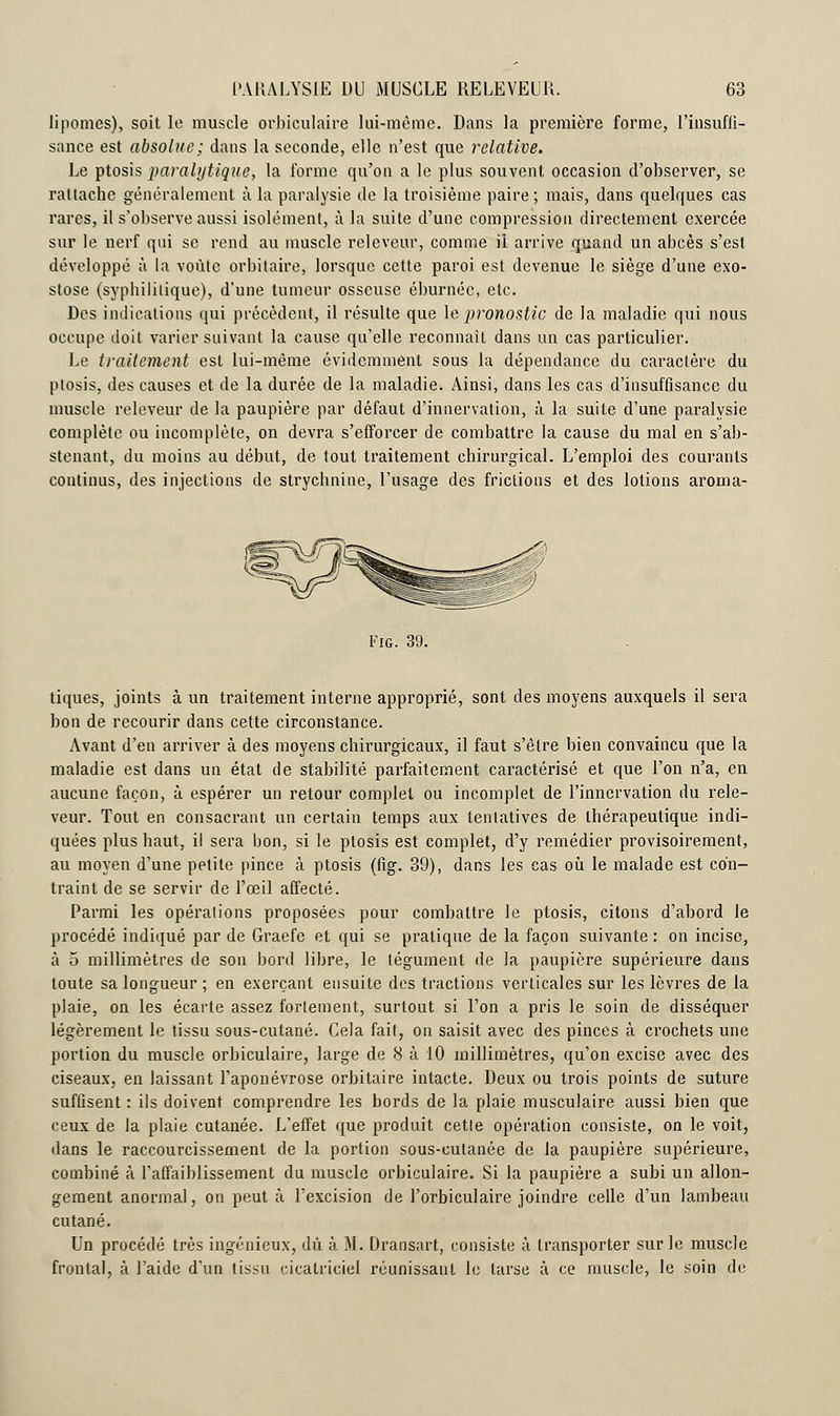 lipomes), soit le muscle orbiculaire lui-même. Dans la première forme, l'insuffi- sance est absolue; dans la seconde, elle n'est que relative. Le ptosis paralytique, la forme qu'on a le plus souvent occasion d'observer, se rattache généralement à la paralysie de la troisième paire ; mais, dans quelques cas rares, il s'observe aussi isolément, à la suite d'une compression directement exercée sur le nerf qui se rend au muscle releveur, comme il arrive quand un abcès s'est développé à la voûte orbitaire, lorsque cette paroi est devenue le siège d'une exo- stose (syphilitique), d'une tumeur osseuse éburnéc, etc. Des indications qui précèdent, il résulte que le pronostic de la maladie qui nous occupe doit varier suivant la cause qu'elle reconnaît dans un cas particulier. Le traitement est lui-même évidemment sous la dépendance du caractère du ptosis, des causes et de la durée de la maladie. Ainsi, dans les cas d'insuffisance du muscle releveur de la paupière par défaut d'innervation, à la suite d'une paralysie complète ou incomplète, on devra s'efforcer de combattre la cause du mal en s'ab- stenant, du moins au début, de tout traitement chirurgical. L'emploi des courants continus, des injections de strychnine, l'usage des frictions et des lotions aroma- Fig. 39. tiques, joints à un traitement interne approprié, sont des moyens auxquels il sera bon de recourir dans cette circonstance. Avant d'en arriver à des moyens chirurgicaux, il faut s'être bien convaincu que la maladie est dans un état de stabilité parfaitement caractérisé et que l'on n'a, en aucune façon, à espérer un retour complet ou incomplet de l'innervation du rele- veur. Tout en consacrant un certain temps aux tentatives de thérapeutique indi- quées plus haut, il sera bon, si le ptosis est complet, d'y remédier provisoirement, au moyen d'une petite pince à ptosis (tig. 39), dans les cas où le malade est con- traint de se servir de l'œil affecté. Parmi les opérations proposées pour combattre le ptosis, citons d'abord le procédé indiqué par de Graefe et qui se pratique de la façon suivante : on incise, à 5 millimètres de son bord libre, le tégument de la paupière supérieure dans toute sa longueur ; en exerçant ensuite des tractions verticales sur les lèvres de la plaie, on les écarte assez fortement, surtout si l'on a pris le soin de disséquer légèrement le tissu sous-cutané. Cela fait, on saisit avec des pinces à crochets une portion du muscle orbiculaire, large de 8 à 10 millimètres, qu'on excise avec des ciseaux, en laissant l'aponévrose orbitaire intacte. Deux ou trois points de suture suffisent : ils doivent comprendre les bords de la plaie musculaire aussi bien que ceux de Ja plaie cutanée. L'effet que produit cette opération consiste, on le voit, dans le raccourcissement de la portion sous-cutanée de la paupière supérieure, combiné à l'affaiblissement du muscle orbiculaire. Si la paupière a subi un allon- gement anormal, on peut à l'excision de l'orbiculaire joindre celle d'un lambeau cutané. Un procédé très ingénieux, dû à M. Dransart, consiste à transporter sur le muscle frontal, à l'aide d'un tissu cicatriciel réunissant le tarse à ce muscle, le soin de