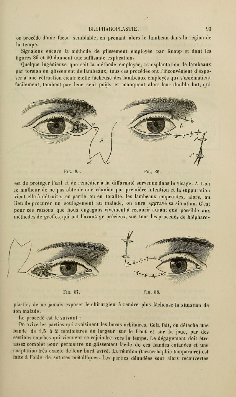 on procède d'une façon semblable, en prenant alors le lambeau dans la région de la tempe. Signalons encore la méthode de glissement employée par Knapp et dont les ligures 89 et 90 donnent une suflîsanle explication. Quelque ingénieuse que soit la méthode employée, transplantation de lambeaux par torsion ou glissement de lambeaux, tous ces procédés ont l'inconvénient d'expo- ser à une rétraction cicatricielle fâcheuse des lambeaux employés qui s'œdématienl facilement, tombent par leur seul poids et manquent alors leur double but, qui Fig. 85. Fig. 86. est de protéger l'œil et de remédier à la difformité survenue dans le visage. A-t-on le malheur de ne pas obtenir une réunion par première intention et la suppuration vient-elle à détruire, en partie ou en totalité, les lambeaux empruntés, alors, au lieu de procurer un soulagement au malade, on aura aggravé sa situation. C'est pour ces raisons que nous engagons vivement à recourir autant que possible aux méthodes de greffes, qui ont l'avantage précieux, sur tous les procédés de blépharo- Fig. 87. Fig. 88. piaslie, de ne jamais exposer le chirurgien à rendre plus fâcheuse la situation de son malade. Le procédé est le suivant : On avive les parties qui avoisinent les bords orbitaires. Cela fait, on détache une bande de 1,5 à 2 centimètres de largeur sur le front et sur la joue, par des sections courbes qui viennent se rejoindre vers la tempe. Le dégagement doit être assez complet pour permettre un glissement facile de ces bandes cutanées et une coaptation très exacte de leur bord avivé. La réunion (tarsorrhaphie temporaire) est faite à l'aide de sutures métalliques. Les parties dénudées sont alors recouvertes