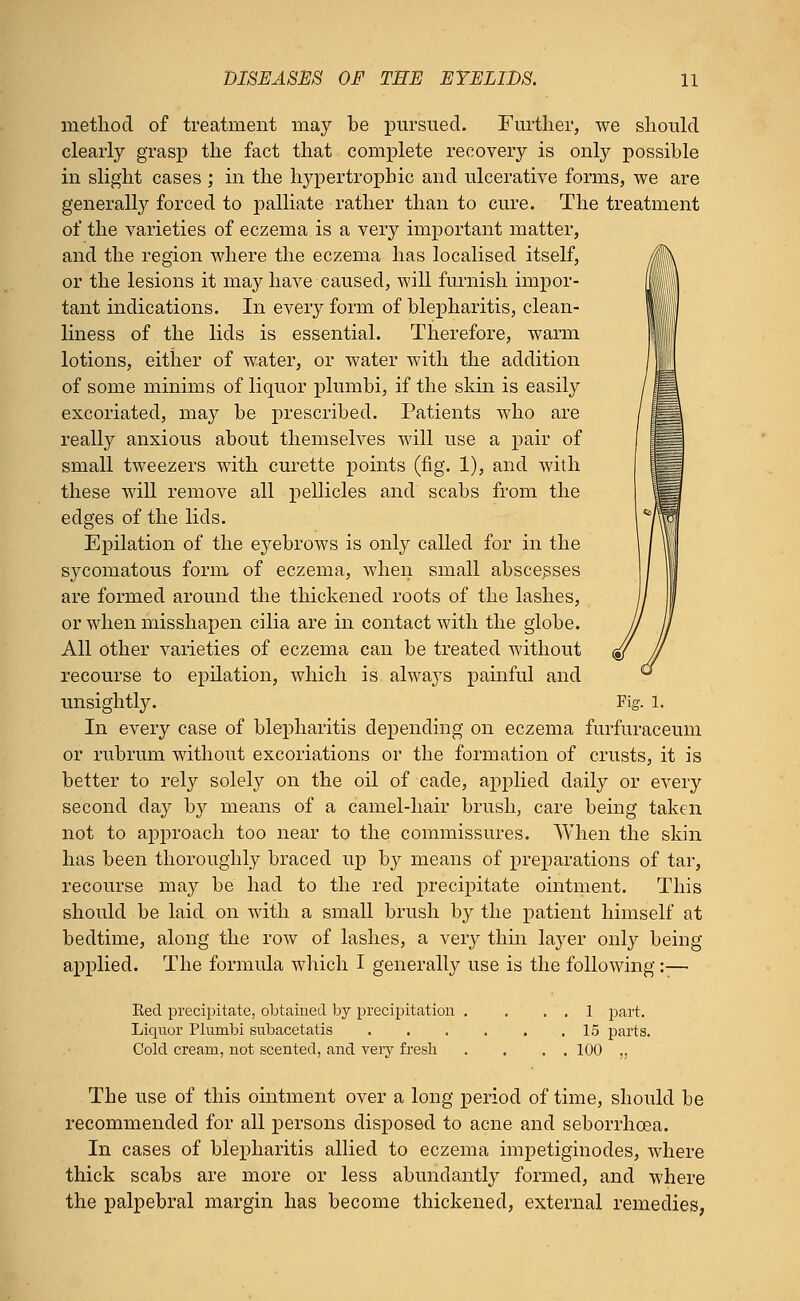 method of treatment may be pursued. Further, we should clearly grasp the fact that complete recovery is only possible in slight cases ; in the hypertrophic and ulcerative forms, we are generally forced to palliate rather than to cure. The treatment of the varieties of eczema is a very important matter, and the region where the eczema has localised itself, or the lesions it may have caused, will furnish impor- tant indications. In every form of blepharitis, clean- liness of the lids is essential. Therefore, warm lotions, either of water, or water with the addition of some minims of liquor plumbi, if the skin is easily excoriated, may be prescribed. Patients who are really anxious about themselves will use a pair of small tweezers with curette points (fig. 1), and with these will remove all pellicles and scabs from the edges of the lids. Epilation of the eyebrows is only called for in the sycomatous form of eczema, when small abscesses are formed around the thickened roots of the lashes, or when misshapen cilia are in contact with the globe. All other varieties of eczema can be treated without recourse to epilation, which is always painful and unsightly. Fig. 1. In every case of blepharitis depending on eczema furfuraceum or rubrum without excoriations or the formation of crusts, it is better to rely solely on the oil of cade, applied daily or every second day by means of a camel-hair brush, care being taken not to approach too near to the commissures. When the skin has been thoroughly braced up by means of preparations of tar, recourse may be had to the red precipitate ointment. This should be laid on with a small brush by the patient himself at bedtime, along the row of lashes, a very thin layer only being applied. The formula which I generally use is the following :— Keel precipitate, obtained by precipitation . . . . 1 part. Liquor Plumbi subacetatis . . . . . .15 parts. Cold cream, not scented, and very fresh . . . . 100 „ The use of this ointment over a long period of time, should be recommended for all persons disposed to acne and seborrhcea. In cases of blepharitis allied to eczema impetiginodes, where thick scabs are more or less abundantly formed, and where the palpebral margin has become thickened, external remedies,