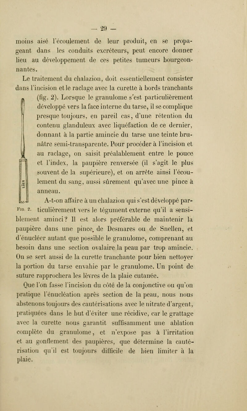 moins aisé l'écoulement de leur produit, en se propa- geant dans les conduits excréteurs, peut encore donner lieu au développement de ces petites tumeurs bourgeon- nantes. Le traitement du chalazion, doit essentiellement consister dans L'incision et le raclage avec la curette à bords tranchants C(fig. 2). Lorsque le granulome s'est particulièrement développé vers la face interne du tarse, il se complique presque toujours, en pareil cas, d'une rétention du contenu glanduleux avec liquéfaction de ce dernier, donnant à la partie amincie du tarse une teinte bru- nâtre semi-transparente. Pour procéder à l'incision et au raclage, on saisit préalablement entre le pouce et l'index, la paupière renversée (il s'agit le plus souvent de la supérieure), et on arrête ainsi l'écou- lement du sang, aussi sûrement qu'avec une pince à anneau. A-t-on affaire à un chalazion qui s'est développé par- FxG 2- ticulièrement vers le tégument externe qu'il a sensi- blement aminci? Il est alors préférable de maintenir la paupière dans une pince, de Desmares ou de Snellen, et d'énucléer autant que possible le granulome, comprenant au besoin dans une section ovalaire la peau par trop amincie. On se sert aussi de la curette tranchante pour bien nettoyer la portion du tarse envahie par le granulome. Un point de suture rapprochera les lèvres de la plaie cutanée. Que l'on fasse l'incision du côté de la conjonctive ou qu'on pratique l'énucléation après section de la peau, nous nous abstenons toujours des cautérisations avec le nitrate d'argent, pratiquées dans le but d'éviter une récidive, car le grattage avec la curette nous garantit suffisamment une ablation complète du granulome, et n'expose pas à l'irritation et au gonflement des paupières, que détermine la cauté- risation qu'il est toujours difficile de bien limiter à la plaie.