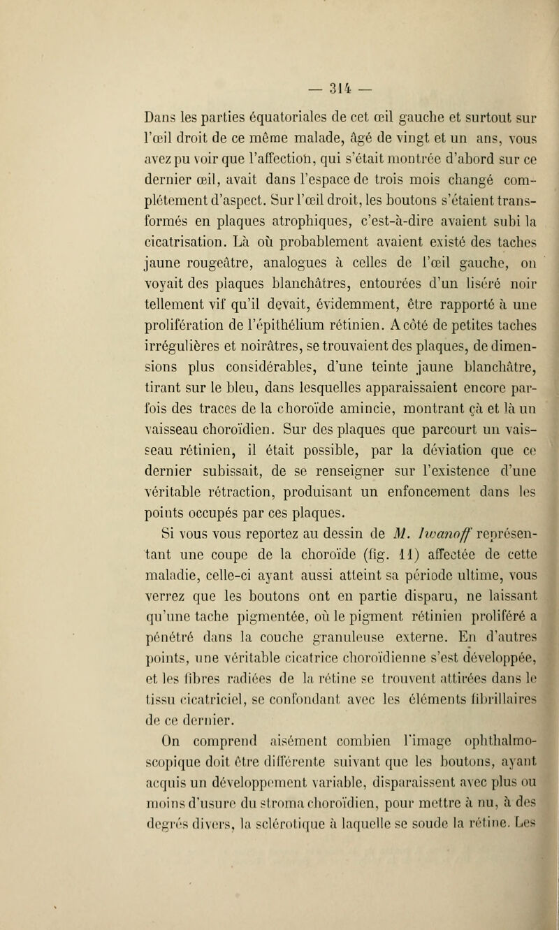 Dans les parties équatoriales de cet œil gauche et surtout sur l'œil droit de ce môme malade, âgé de vingt et un ans, vous avez pu voir que l'affection, qui s'était montrée d'abord sur ce dernier œil, avait dans l'espace de trois mois changé com- plètement d'aspect. Sur l'œil droit, les boutons s'étaient trans- formés en plaques atrophiques, c'est-à-dire avaient subi la cicatrisation. Là où probablement avaient existé des taches jaune rougeâtre, analogues à celles de l'œil gauche, on voyait des plaques blanchâtres, entourées d'un liséré noir tellement vif qu'il devait, évidemment, être rapporté à une prolifération de l'épithélium rétinien. A côté de petites taches irrégulières et noirâtres, se trouvaient des plaques, de dimen- sions plus considérables, d'une teinte jaune blanchâtre, tirant sur le bleu, dans lesquelles apparaissaient encore par- fois des traces de la choroïde amincie, montrant çà et là un vaisseau choroïdien. Sur des plaques que parcourt un vais- seau rétinien, il était possible, par la déviation que ce dernier subissait, de se renseigner sur l'existence d'une véritable rétraction, produisant un enfoncement dans les points occupés par ces plaques. Si vous vous reportez au dessin de M. Iwanoff représen- tant une coupe de la choroïde (fig. 11) affectée de cette maladie, celle-ci ayant aussi atteint sa période ultime, vous verrez que les boutons ont en partie disparu, ne laissant qu'une tache pigmentée, où le pigment rétinien proliféré a pénétré dans la couche granuleuse externe. En d'autres points, une véritable cicatrice choroïdienne s'est développée, et les libres radiées de la rétine se trouvent attirées dans le Ijssu cicatriciel, se confondant avec les éléments iibrillaires de ce dernier. On comprend aisément combien l'image ophthalmo- scopique doit être différente suivant que les boutons, ayant acquis un développement variable, disparaissent avec plus ou moins d'usure du stroma choroïdien, pour mettre à nu, à des degrés divers, la sclérotique à laquelle se soude la rétine. Les
