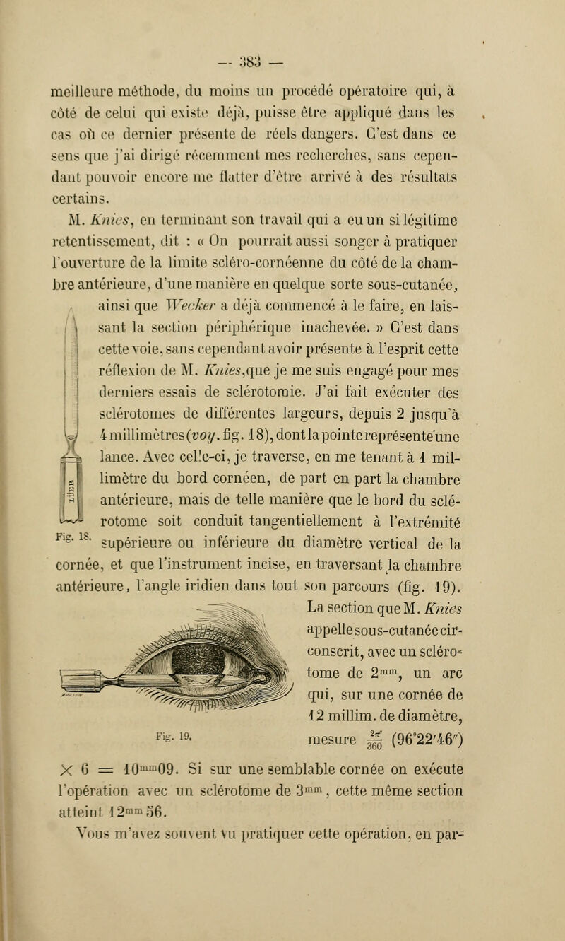 38; meilleure méthode, du moins un procédé opératoire qui, à coté de celui qui existe déjà, puisse être appliqué dans les cas où ce dernier présente de réels dangers. C'est dans ce sens que j'ai dirigé récemment mes recherches, sans cepen- dant pouvoir encore me flatter d'être arrivé à des résultats certains. M. Knies, en terminant son travail qui a eu un si légitime retentissement, dit : «On pourrait aussi songer à pratiquer l'ouverture de la limite scléro-cornéenne du côté de la cham- bre antérieure, d'une manière en quelque sorte sous-cutanée, ainsi que Wecker a déjà commencé à le faire, en lais- sant la section périphérique inachevée. » C'est dans cette voie, sans cependant avoir présente à l'esprit cette réflexion de M. Knies,que je me suis engagé pour mes derniers essais de sclérotonoie. J'ai fait exécuter des sclérotomes de différentes largeurs, depuis 2 jusqu'à 4millimètres(woy.fig. 18), dont la pointereprésente'une lance. Avec celïe-ci, je traverse, en me tenant à 1 mil- limètre du bord cornéen, de part en part la chambre antérieure, mais de telle manière que le bord du sclé- rotome soit conduit tangentiellement à l'extrémité supérieure ou inférieure du diamètre vertical de la cornée, et que l'instrument incise, en traversant la chambre antérieure, l'angle indien dans tout son parcours (fig. 19). La section que M. Knies appelle sou s-cutanée cir- conscrit, avec un scléro- tome de 2mm, un arc qui, sur une cornée de 12 millim. de diamètre, Fis-19- mesure |jj (9622'46) X 6 = 10mm09. Si sur une semblable cornée on exécute l'opération avec un sclérotome de 3mm , cette même section atteint i2mm56. Vous m'avez souvent vu pratiquer cette opération, en par- Fur. 18.