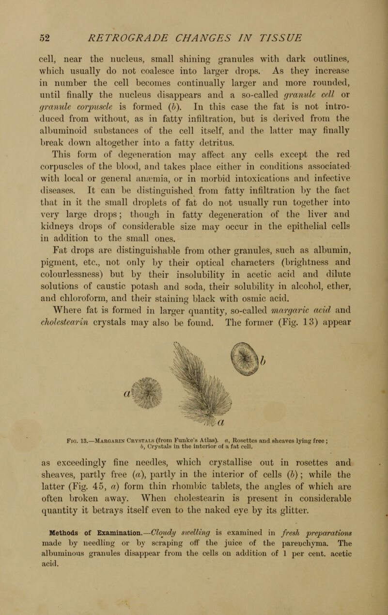 cell, near the nucleus, small shining granules with dark outlines, which usually do not coalesce into larger drops. As they increase in number the cell becomes continually larger and more rounded, until finally the nucleus disappears and a so-called granitic cell or granule corpuscle is formed (h). In this case the fat is not intro- duced from without, as in fatty infiltration, but is derived from the albuminoid substances of the cell itself, and the latter may finally break down altogether into a fatty detritus. This form of degeneration may affect any cells except the red corpuscles of the blood, and takes place either in conditions associated with local or general anaemia, or in morbid intoxications and infective diseases. It can be distinguished from fatty infiltration by the fact that in it the small droplets of fat do not usually run together into very large drops; though in fatty degeneration of the liver and kidneys drops of considerable size may occur in the epithelial cells in addition to the small ones. Fat drops are distinguishable from other granules, such as albumin, pigment, etc., not only by their optical characters (brightness and colourlessness) but by their insolubility in acetic acid and dilute solutions of caustic potash and soda, their solubility in alcohol, ether, and chloroform, and their staining black with osmic acid. Where fat is formed in larger quantity, so-called margaric acid and cholcstearin crystals may also be found. The former (Fig. 13) appear Fig. 13.—Margarin Crystals (from Funke's Atlas), a, Ro55ettes and sheaves lying free ; b, Crystals in the interior of a fat cell. as exceedingly fine needles, which crystallise out in rosettes and sheaves, partly free (<x), partly in the interior of cells (h); while the latter (Fig. 45, a) form thin rhombic tablets, the angles of which are often broken away. When cholestearin is present in considerable quantity it betrays itself even to the naked eye by its glitter. Methods of Examination.—Cloudy swelling is examined in fresh 'preparations made by needling or by scraping off the juice of the parenchyma. The albuminous granules disappear from the cells on addition of 1 per cent, acetic acid.