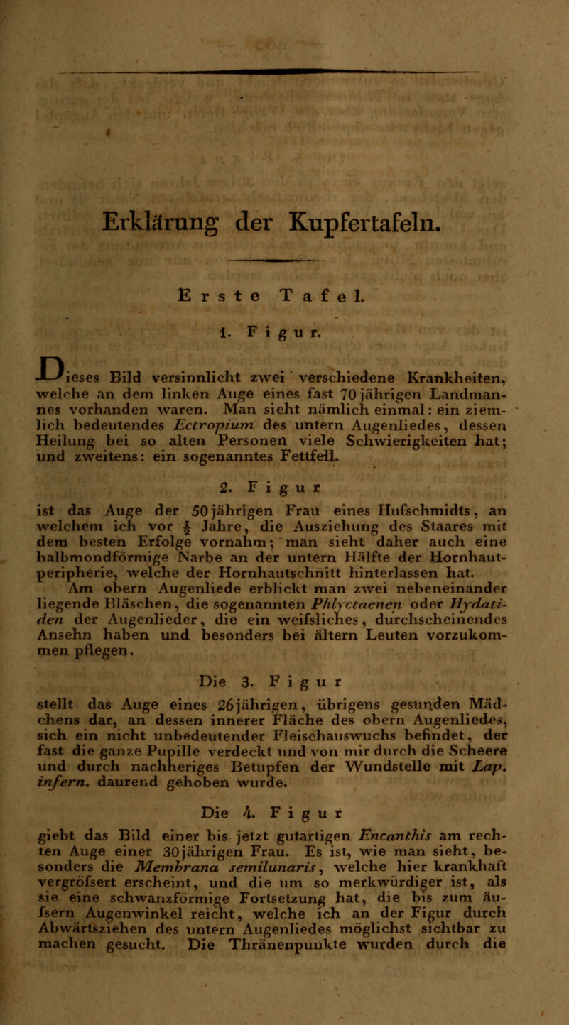 Erklärung der Kupfertafeln. Erste Tafel, 1. Figur. D, rieses Bild versinnlicht zwei verschiedene Krankheiten, Vielehe an dem linken Auge eines fast 70 jährigen Landman- nes vorhanden waren. Man sieht nämlich einmal: ein ziem- lich bedeutendes Ectropium des untern Augenliedes, dessen Heilung bei so alten Personen viele Schwierigkeiten hat; und zweitens: ein sogenanntes Fettfell. 2. Figur ist das Auge der 50jährigen Frau eines Hufschmidts, an welchem ich vor \ Jahre, die Ausziehung des Staares mit dem besten Erfolge vornahm; man sieht daher auch eine halbmondförmige Narbe an der untern Hälfte der Hornhaut- peripherie, welche der Hornhautschnitt hinterlassen hat. Am obern Augenliede erblickt man zwei nebeneinander liegende Bläschen, die sogenannten Phlyctaenen oder Hjdati- den der Augenlieder, die ein weifsliches, durchscheinendes Ansehn haben und besonders bei altern Leuten vorzukom- men pflegen. Die 3. Figur stellt das Auge eines 26jährigen, übrigens gesunden Mäd- chens dar, an dessen innerer Fläche des obern Augenliedes, sich ein nicht unbedeutender Fleischauswuchs befindet, der fast die ganze Pupille verdeckt und von mir durch die Scheere und durch nachheriges Betupfen der Wundstelle mit Lap. infern, daurend gehoben wurde. Die i, Figur giebt das Bild einer bis jetzt gutartigen Encantlüs am rech- ten Auge einer 30jährigen Frau. Es ist, wie man sieht, be- sonders die Membrana semilunaris, welche hier krankhaft vergröfsert erscheint, und die um so merkwürdiger ist, als sie eine schwanzförmige Fortsetzung hat, die bis zum äu- i'sern Augenwinkel reicht, welche ich an der Figur durch Abwärtsziehen des untern Augenliedes möglichst sichtbar zu machen gesucht. Die Thränenpunkte wurden durch die