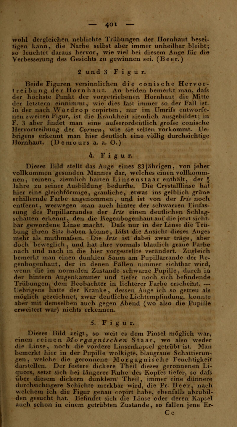 wohl dergleichen neblichte Trübungen der Hornhaut besei- tigen kann, die Narbe selbst aber immer unheilbar bleibt; so leuchtet daraus hervor, wie viel bei diesem Auge für die Verbesserung des Gesichts zu gewinnen sei. (Beer.) 2 und 3 Figur. Beide Figuren versinnlichen die conische Hervor- treibu ng der Hornhaut. An beiden bemerkt man, dafs der höchste P-unkt der vorgetriebenen Hornhaut die Mitte der letztern einnimmt, wie dies fast immer so der Fall ist. In der nach Wardrop copirten, nur im Umrifs entworfe- nen zweiten Figur, ist die Krankheit ziemlich ausgebildet; in F. 3 aber findet man eine aufserordentlich grofse conische Hervortreibung der Cornea, wie sie selten vorkommt. Ue- brigens erkennt man hier deutlich eine völlig durchsichtige Hornhaut. (Demours a. a. O.) 4. Figur. Dieses Bild stellt das Auge eines 83 jährigen, von jeher vollkommen gesunden Mannes dar, welches einen vollkomm- nen, reinen, ziemlich harten Linsenstaar enthält, der -J Jahre zu seiner Ausbildung bedurfte. Die Crystalllinse hat hier eine gleichförmige, grauliche, etwas ins gelblich grüne schillernde Farbe angenommen, und ist von der Iris noch entfernt, weswegen man auch hinter der schwarzen Einfas- sung des Pupillarrandes der Iris einen deutlichen Schlag- schatten erkennt, den die Regenbogenhaut auf die jetzt sicht- bar gewordene Linse macht. Dafs nur in der Linse die Trü- bung ihren Sitz haben könne, läfst die Ansicht dieses Auges mehr als muthmafsen. Die Iris ist dabei zwar träge, aber doch beweglich, und hat ihre vormals blaulich graue Farbe nach und nach in die hier vorgestellte verändert. Zugleich bemerkt man einen dunklen Saum am Pupillarrande der Re- genbogenhaut, der in denen Fällen nimmer sichtbar wird, wenn die im normalen Zustande schwarze Pupille, durch in der hintern Augenkammer und tiefer noch sich befindende Trübungen, dem Beobachter in lichterer Farbe erscheint. — Uebrigens hatte der Kranke, dessen Auge ich so getreu als möglich gezeichnet, zwar deutliche Lichtempfindung, konnte aber mit demselben auch gegen Abend (wo also die Pupille erweitert war) nichts erkennen. 5. Figur. Dieses Bild zeigt, so weit es dem Pinsel möglich war, einen reinen Mo rgagnischen Staar, wo also weder die Linse, noch die vordere Linsenkapsel getrübt ist. Man bemerkt hier in der Pupille wolkigte, blaugraue Schattierun- gen, welche die geronnene Morgagnische Feuchtigkeit darstellen. Der festere dickere Theil dieses geronnenen Li- quors, setzt sich bei längerer Ruhe des Kopfes tiefer, so dafs über diesem dickern dunklern' Theil, immer eine dünnere durchsichtigere Schichte merkbar wird, die Pr. Beer, nach welchem ich die Figur genau copirt habe, ebenfalls abzubil- den gesucht hat. Befindet sich die Linse oder deren Kapsel auch schon in einem getrübten Zustande, so fallen jene Er- Cc