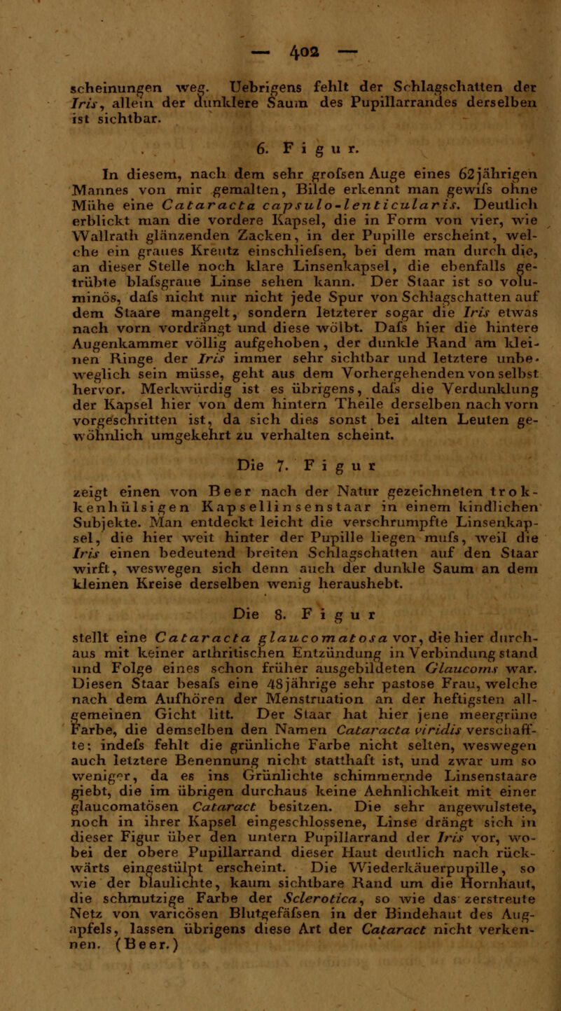 scheinungen weg. Uebrigens fehlt der Schlagschatten der Iris, allein der dunklere Saum des Pupillarrandes derselben ist sichtbar. 6. Figur. In diesem, nach dem sehr grofsen Auge eines 62 jährigen Mannes von mir gemalten, Bilde erkennt man gewifs ohne Mühe eine Cataracta capsulo-lenticularis. Deutlich erblickt man die vordere Kapsel, die in Form von vier, wie Wallrath glänzenden Zacken, in der Pupille erscheint, wel- che ein graues Kreutz einschliefsen, bei dem man durch die, an dieser Stelle noch klare Linsenkapsel, die ebenfalls ge- trübte blafsgraue Linse sehen kann. Der Staar ist so volu- minös, dafs nicht nur nicht jede Spur von Schlagschatten auf dem Staare mangelt, sondern letzterer sogar die Iris etwas nach vorn vordrängt und diese wölbt. Dafs hier die hintere Augenkammer völlig aufgehoben, der dunkle Rand am Idei- nen Ringe der Iris immer sehr sichtbar und letztere unbe- weglich sein müsse, geht aus dem Vorhergehenden von selbst: hervor. Merkwürdig ist es übrigens, dafs die Verdunklung der Kapsel hier von dem hintern Theile derselben nach vorn vorgeschritten ist, da sich dies sonst bei alten Leuten ge- wöhnlich umgekehrt zu verhalten scheint. Die 7- F i g u r zeigt einen von Beer nach der Natur gezeichneten trok- kenhülsi gen Kapsellinsenstaar in einem kindlichen Subjekte. Man entdeckt leicht die verschrumpfte Linsenkap- sel, die hier weit hinter der Pupille liegen mufs, weil die Iris einen bedeutend breiten Schlagschatten auf den Staar wirft, weswegen sich denn auch der dunkle Saum an dem Die 8. Figur stellt eine Cataracta glaucomatosa vor, die hier durch- aus mit keiner arthrotischen Entzündung in Verbindung stand und Folge eines schon früher ausgebildeten Glaucoms war. Diesen Staar besafs eine 48jährige sehr pastose Frau, welche nach dem Aufhören der Menstruation an der heftigsten all- gemeinen Gicht litt. Der Staar hat hier jene meergrüne Farbe, die demselben den Namen Cataracta viridis verschaff- te: indefs fehlt die grünliche Farbe nicht selten, weswegen auch letztere Benennung nicht statthaft ist, und zwar um so weniger, da es ins Grünlichte schimmernde Linsenstaare giebt, die im übrigen durchaus keine Aehnlichkeit mit einer glaucomatösen Cataract besitzen. Die sehr angewulstete, noch in ihrer Kapsel eingeschlossene, Linse drängt sich in dieser Figur über den untern Pupillarrand der Iris vor, wo- bei der obere Pupillarrand dieser Haut deutlich nach rück- wärts eingestülpt erscheint. Die Wiederkäuerpupille, so wie der blaulicnte, kaum sichtbare Rand um die Hornhaut, die schmutzige Farbe der Sclerotica, so wie das zerstreute Netz von varicösen Blutgefäfsen in der Bindehaut des Aug- apfels, lassen übrigens diese Art der Cataract nicht verken- nen. (Beer.)