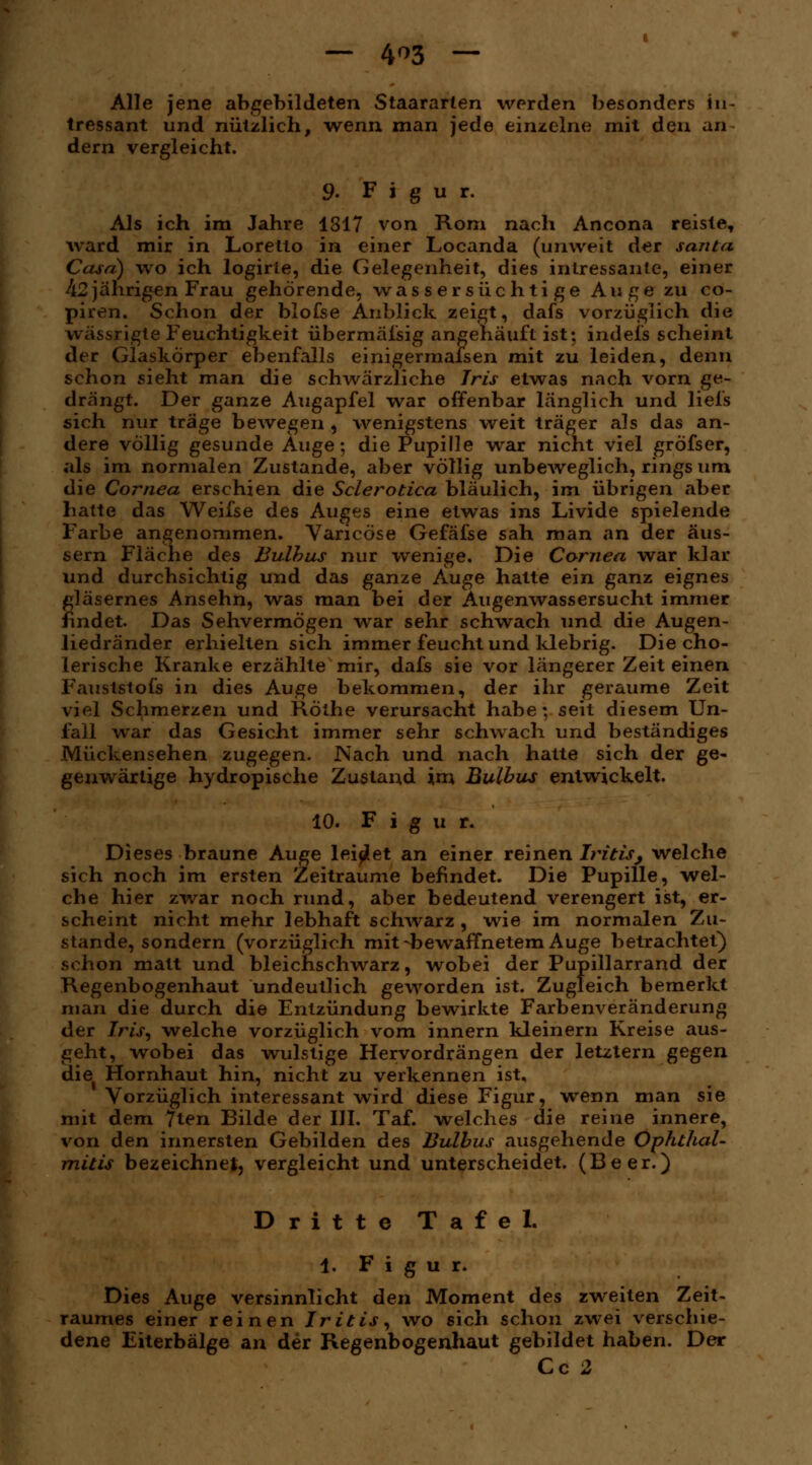 — 4*3 — Alle jene abgebildeten Staararlen werden besonders in- tressant und nützlich, wenn man jede einzelne mit den an dem vergleicht. 9. Figur. Als ich im Jahre 1317 von Rom nach Ancona reiste, ward mir in Loretto in einer Locanda (unweit der santa Casd) wo ich logirte, die Gelegenheit, dies intressante, einer 42jährigen Frau gehörende, wassersüchtige Auge zu co- piren. Schon der blofse Anblick zeigt, dafs vorzüglich die wässrigte Feuchtigkeit übermäfsig angehäuft ist: indeis scheint der Glaskörper ebenfalls einigermaßen mit zu leiden, denn schon sieht man die schwärzliche Iris etwas nach vorn ge- drängt. Der ganze Augapfel war offenbar länglich und liefs sich nur träge bewegen , wenigstens weit träger als das an- dere völlig gesunde Auge; die Pupille war nicht viel gröfser, als im normalen Zustande, aber völlig unbeweglich, rings um die Cornea erschien die Sclerotica bläulich, im übrigen aber hatte das Weifse des Auges eine etwas ins Livide spielende Farbe angenommen. Varicöse Gefäfse sah man an der äus- sern Fläche des Bulbus nur wenige. Die Cornea war klar und durchsichtig und das ganze Auge hatte ein ganz eignes gläsernes Ansehn, was man bei der Augenwassersucht immer findet. Das Sehvermögen war sehr schwach und die Augen- liedränder erhielten sich immer feucht und klebrig. Die cho- lerische Kranke erzählte mir, dafs sie vor längerer Zeit einen Fauststofs in dies Auge bekommen, der ihr geraume Zeit viel Schmerzen und Köthe verursacht habe; seit diesem Un- fall war das Gesicht immer sehr schwach und beständiges Mückensehen zugegen. Nach und nach hatte sich der ge- genwärtige hydropische Zustand im Bulbus entwickelt. 10. F ig u r. Dieses braune Auge leitet an einer reinen Iritis\ welche sich noch im ersten Zeiträume befindet. Die Pupille, wel- che hier zwar noch rund, aber bedeutend verengert ist, er- scheint nicht mehr lebhaft schwarz , wie im normalen Zu- stande, sondern (vorzüglich mit-bewaffnetem Auge betrachtet) schon matt und bleichschwarz, wobei der Pupillarrand der Regenbogenhaut undeutlich geworden ist. Zugleich bemerkt man die durch die Entzündung bewirkte Farbenveränderung der Iris, welche vorzüglich vom innern kleinern Kreise aus- geht, wobei das wulstige Hervordrängen der letztern gegen die Hornhaut hin, nicht zu verkennen ist. Vorzüglich interessant wird diese Figur, wenn man sie mit dem 7ten Bilde der III. Taf. welches die reine innere, von den innersten Gebilden des Bulbus ausgehende Ophthal- mitis bezeichnet, vergleicht und unterscheidet. (Beer.) Dritte Tafel. 1. Figur. Dies Auge versinnlicht den Moment des zweiten Zeit- raumes einer reinen Iritis, wo sich schon zwei verschie- dene Eilerbälge an der Regenbogenhaut gebildet haben. Der Cc 2