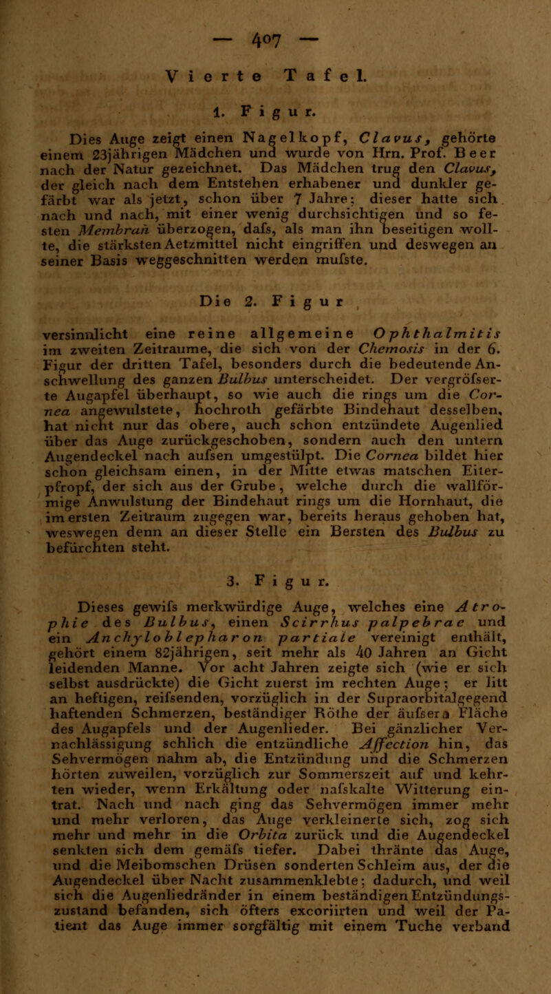 — 4°7 — Vierte Tafel. 1. Figur. Dies Auge zeigt einen Nagelkopf, Clavus, gehörte einem 23jährigen Mädchen und wurde von Hrn. Prof. Beer nach der Natur gezeichnet. Das Mädchen trug den Clavus, der gleich nach dem Entstehen erhahener und dunkler ge- färbt war als jetzt, schon über 7 Jahre; dieser hatte sich nach und nach, mit einer wenig durchsichtigen und so fe- sten Membran überzogen, dafs, als man ihn beseitigen woll- te, die stärksten Aetzmittel nicht eingriffen und deswegen an seiner Basis weggeschnitten werden mufste. Die 2. Figur versinnlicht eine reine allgemeine Ophthalmitis im zweiten Zeiträume, die sich von der Chemosis in der 6. Figur der dritten Tafel, besonders durch die bedeutende An- schwellung des ganzen Bulbus unterscheidet. Der vergröfser- te Augapfel überhaupt, so wie auch die rings um die Cor- nea angewulstete, hochroth gefärbte Bindehaut desselben, hat nicht nur das obere, auch schon entzündete Augenlied über das Auge zurückgeschoben, sondern auch den untern Augendeckel nach aufsen umgestülpt. Die Cornea bildet hier schon gleichsam einen, in der Mitte etwas matschen Eiter- pfropf, der sich aus der Grube, welche durch die wallför- mige Anwulstung der Bindehaut rings um die Hornhaut, die im ersten Zeitraum zugegen war, bereits heraus gehoben hat, weswegen denn an dieser Stelle ein Bersten des Bulbus zu befürchten steht. 3. Figur. Dieses gewifs merkwürdige Auge, welches eine Atro- phie des Bulbus, einen Scirrhus palp ebrae und ein Anchylobl ephar on partiale vereinigt enthält, gehört einem 82jährigen, seit mehr als 40 Jahren an Gicht leidenden Manne. Vor acht Jahren zeigte sich (wie er sich selbst ausdrückte) die Gicht zuerst im rechten Auge; er litt an heftigen, reifsenden, vorzüglich in der Supraorbitalgegend haftenden Schmerzen, beständiger Röthe der äufser$ Fläche des Augapfels und der Augenlieder. Bei gänzlicher Ver- nachlässigung schlich die entzündliche Affection hin, das Sehvermögen nahm ab, die Entzündung und die Schmerzen hörten zuweilen, vorzüglich zur Sommerszeit auf und kehr- ten wieder, wenn Erkältung oder nafskalte Witterung ein- trat. Nach und nach ging das Sehvermögen immer mehr und mehr verloren, das Auge verkleinerte sich, zog sich mehr und mehr in die Orbita zurück und die Augendeckel senkten sich dem gemäfs tiefer. Dabei thränte aas Auge, und die Meibomschen Drüsen sonderten Schleim aus, der die Augendeckel über Nacht zusammenklebte; dadurch, und weil sich die Augenliedränder in einem beständigen Entzündungs- zustand befanden, sich öfters excoriirten und weil der Pa- tient das Auge immer sorgfältig mit einem Tuche verband