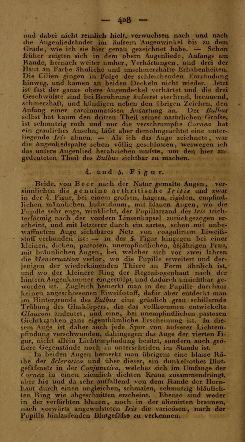 — 4<>Ö — und dabei nicht reinlich hielt, verwuchsen nach und nach die Augenliedränder im äufsern Augenwinkel bis zu dem Grade, wie ich sie hier genau gezeichnet habe. — Schon früher zeigten sich in dem obern Augenliede, Anfangs am Rande, hernach weiter umher, Verhärtungen, und drei der Haut an Farbe ähnliche und unschmerzhafie Erhabenheiten. Die Cilien g\ngen in Folge der schleichenden Entzündung hinweg, und kamen an beiden Deckeln nicht wieder. Jetzt ist fast der ganze obere Augendeckel verhärtet und die drei Geschwülste sind bei Berührung äufserst stechend, brennend, schmerzhaft, und kündigen neben den übrigen Zeichen, den Anfang einer carcinomatösen Ausartung an. Der Bulbus selbst hat kaum den dritten Theil seiner natürlichen Gröfse, ist schmutzig roth und nur die verschrumpfte Cornea hat ein grauliches Ansehn, läfst aber demohngeachtet eine unter- liegende Iris ahnen. — Als ich das Auge zeichnete, war die Augenliedspalte schon völlig geschlossen, weswegen ich das untere Augenlied herabziehen mufste, um den hier an- gedeuteten Theil des Bulbus sichtbar zu machen. 4. u nd 5. F i g u r. Beide, von Beer nach der Natur gemalte Augen, ver- siimliohen die genuine arlh ritische Iritis und zwar in der A. Figur, bei einem grofsen, hagern, rigiden, empfind- lichen männlichen Individuum, mit blauen Augen^ wo die Pupille sehr enge^ winklicht, der Pupillarrand der Iris trich- terförmig nach der vordem Linsenkapsel zurückgezogen er- scheint, und mit letzterer durch ein zartes, schon mit unbe- waffnetem Auge sichtbares Netz von coagulirtem Eiweifs- sloff verbunden ist: —- in der 5. Figur hingegen bei einer kleinen, dicken, pastosen, unempfindlichen, //8jährigen Frau, mit bräunlichen Augen, bei welcher sich vor zwei Jahren die Menstruation verlor, wo die Pupille erweitert und der- jenigen der wiederkäuenden Thiere an Form ähnlich ist, und wo der kleinere King der Regenbogenhaut nach der hintern Augenkammer eingestülpt und dadurch unsichtbar ge- worden ist. Zugleich bemerkt man in der Pupille durchaus keinen angeschossenen EiweifsstofF, dafür aber entdeckt man im Hintergrunde des Bulbus eine grünlich grau schillernde Trübung des Glaskörpers, die das vollkommen entwickelte Glaucom andeutet, und eine, bei unempfindlichen paslosen Gichtkranken ganz eigenthümliche Erscheinung ist. In die- sem Auge ist daher auch jede Spur von äufserer Lichtem- pfindung verschwunden, dahingegen das Auge der vierten Fi- gur, nicht allein Lichtempfindung besitzt, sondern auch gro- fsere Gegenstände noch zu unterscheiden im .Stande ist. In beiden Augen bemerkt man übrigens eine blasse Rö- the der Sclerotica und über dieser, ein dunkelrothes Blut- gefäfsnetz in der Conjunctivae welches sich im Umfange der (ornea in einen ziemlich dichten Kranz zusammendrängt, aber hie und da sehr auffallend von dem Rande der Horn- haut durch einen ungleichen, schmalen, schmutzig bläulich- ten Ring wie abgeschnitten erscheint. Ebenso sind weder in der verfärbten blauen, noch in der alienirten braunen, nach vorwärts angewulstelen Iris die varicösen, nach der Pupille hinlaufenden Blutgefäfse zu verkennen.