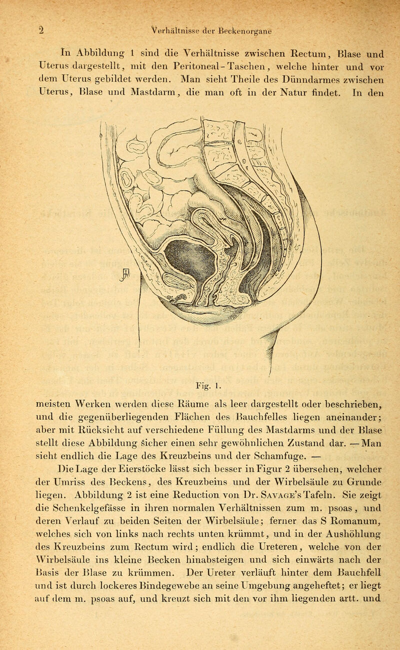 In Abbildung 1 sind die Verhältnisse zwischen Rectum, Blase und Uterus dargestellt, mit den Peritoneal-Taschen, welche hinter und vor dem Uterus gebildet werden. Man sieht Theile des Dünndarmes zwischen Uterus, Blase und Mastdarm, die man oft in der Natur findet. In den Fig. 1. meisten Werken werden diese Räume als leer dargestellt oder beschrieben, und die gegenüberliegenden Flächen des Bauchfelles liegen aneinander; aber mit Rücksicht auf verschiedene Füllung des Mastdarms und der Blase stellt diese Abbildung Sicher einen sehr gewöhnlichen Zustand dar. —Man sieht endlich die Lage des Kreuzbeins und der Schamfuge. — Die Lage der Eierstöcke lässt sich besser in Figur 2 übersehen, welcher der Umriss des Beckens, des Kreuzbeins und der Wirbelsäule zu Grunde liegen. Abbildung 2 ist eine Reduction von Dr. Savage's Tafeln. Sie zeigt die Schenkelgefässe in ihren normalen Verhältnissen zum m. psoas, und deren Verlauf zu beiden Seiten der Wirbelsäule; ferner das S Romanum, welches sich von links nach rechts unten krümmt, und in der Aushöhlung des Kreuzbeins zum Rectum wird; endlich die Ureteren, welche von der Wirbelsäule ins kleine Becken hinabsteigen und sich einwärts nach der Basis der Blase zu krümmen. Der Ureter verläuft hinter dem Bauchfell und ist durch lockeres Bindegewebe an seine Umgebung angeheftet; er liegt auf dem in. psoas auf, und kreuzt sich mit den vor ihm liegenden artt. und