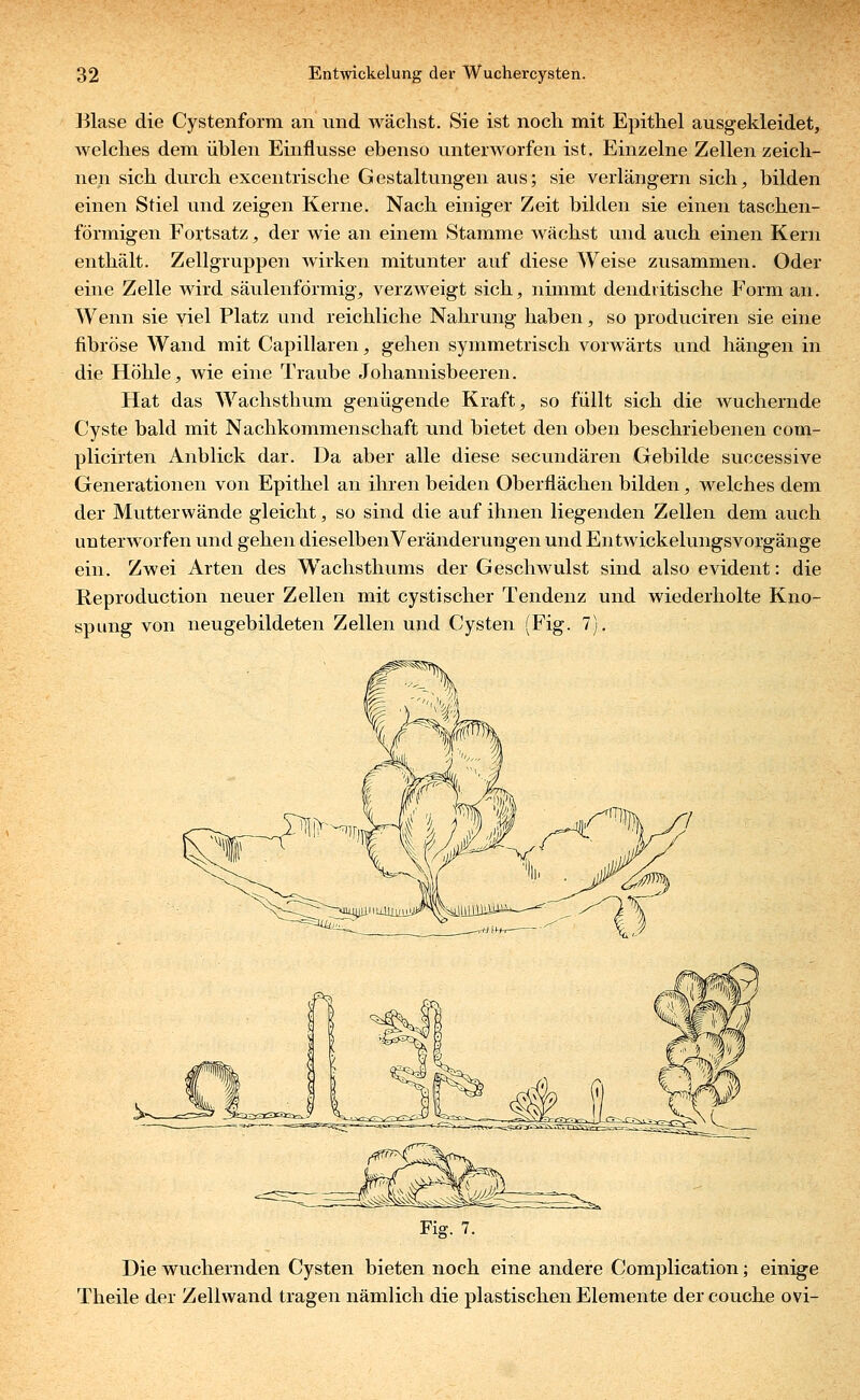 Blase die Cystenform an und wächst. Sie ist noch mit Epithel ausgekleidet, Avelches dem üblen Einflüsse ebenso unterworfen ist. Einzelne Zellen zeich- nen sich durch excentrische Gestaltungen aus; sie verlängern sich, bilden einen Stiel und zeigen Kerne. Nach einiger Zeit bilden sie einen taschen- förmigen Fortsatz, der wie an einem Stamme wächst und auch einen Kern enthält. Zellgruppen wirken mitunter auf diese Weise zusammen. Oder eine Zelle wird säulenförmig, verzweigt sich, nimmt dendritische Form an. Wenn sie viel Platz und reichliche Nahrung haben, so produciren sie eine fibröse Wand mit Capillaren, gehen symmetrisch vorwärts und hängen in die Höhle, wie eine Traube Johannisbeeren. Hat das Wachsthum genügende Kraft, so füllt sich die wuchernde Cyste bald mit Nachkommenschaft und bietet den oben beschriebenen cora- plicirten Anblick dar. Da aber alle diese secundären Gebilde successive Generationen von Epithel an ihren beiden Oberflächen bilden, welches dem der Mutterwände gleicht, so sind die auf ihnen liegenden Zellen dem auch unterworfen und gehen dieselben Veränderungen und Entwickelungsvorgänge ein. Zwei Arten des Wachsthums der Geschwulst sind also evident: die Reproduction neuer Zellen mit cystischer Tendenz und wiederholte Kno- spung von neugebildeten Zellen und Cysten (Fig. 7). Fig. 7. Die wuchernden Cysten bieten noch eine andere Complication; einige Theile der Zellwand tragen nämlich die plastischen Elemente der couche ovi-