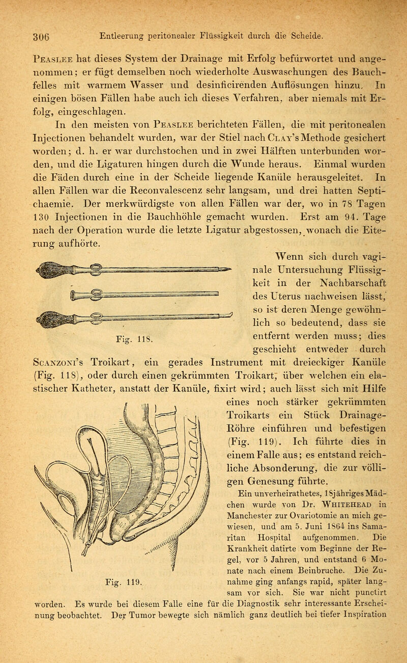 Peaslee hat dieses System der Drainage mit Erfolg befürwortet und ange- nommen; er fügt demselben noch wiederholte Auswaschungen des Bauch- felles mit warmem Wasser und desinficirenden Auflösungen hinzu, In einigen bösen Fällen habe auch ich dieses Verfahren, aber niemals mit Er- folg, eingeschlagen. In den meisten von Peaslee berichteten Fällen, die mit peritonealen Injectionen behandelt wurden, war der Stiel nach Clay's Methode gesichert worden; d. h. er war durchstochen und in zwei Hälften unterbunden wor- den, und die Ligaturen hingen durch die Wunde heraus. Einmal wurden die Fäden durch eine in der Scheide liegende Kanüle herausgeleitet. In allen Fällen war die Reconvalescenz sehr langsam, und drei hatten Septi- chaemie. Der merkwürdigste von allen Fällen war der, wo in 78 Tagen 130 Injectionen in die Bauchhöhle gemacht wurden. Erst am 94. Tage nach der Operation Avurde die letzte Ligatur abgestossen, wonach die Eite- rung aufhörte. Wenn sich durch vagi- nale Untersuchung Flüssig- keit in der Nachbarschaft des Uterus nachweisen lässt, so ist deren Menge gewöhn- lich so bedeutend, dass sie entfernt werden muss; dies geschieht entweder durch Scanzoni's Troikart, ein gerades Instrument mit dreieckiger Kanüle (Fig. 118), oder durch einen gekrümmten Troikart; über welchen ein ela- stischer Katheter, anstatt der Kanüle, fixirt wird; auch lässt sich mit Hilfe eines noch stärker gekrümmten Troikarts ein Stück Drainage- Röhre einführen und befestigen (Fig. 119). Ich führte dies in einem Falle aus; es entstand reich- liche Absonderung, die zur völli- gen Genesung führte. Ein unverheirathetes, 18j ähriges Mäd- chen wurde von Dr. Whitehead in Manchester zur Ovariotomie an mich ge- wiesen, und am 5. Juni 1864 ins Sama- ritan Hospital aufgenommen. Die Krankheit datirte vom Beginne der Re- gel, vor 5 Jahren, und entstand 6 Mo- nate nach einem Beinbi'uche. Die Zu- nahme ging anfangs rapid, später lang- sam vor sich. Sie war nicht punctirt worden. Es wurde bei diesem Falle eine für die Diagnostik sehr interessante Erschei- nung beobachtet. Der Tumor bewegte sich nämlich ganz deutlich bei tiefer Inspiration Fi<?. 118. Fig. 119.