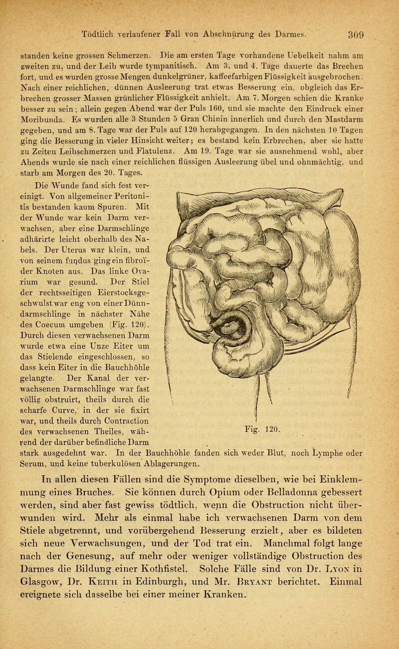 standen keine grossen Schmerzen. Die am ersten Tage vorhandene Uebelkeit nahm am zweiten zu, und der Leib wurde tympanitisch. Am 3. und 4. Tage dauerte das Brechen fort, und es wurden grosse Mengen dunkelgrüner, kaffeefarbigen Flüssigkeit ausgebrochen. Nach einer reichlichen, dünnen Ausleerung trat etwas Besserung ein, obgleich das Er- brechen grosser Massen grünlicher Flüssigkeit anhielt. Am 7. Morgen schien die Kranke besser zu sein; allein gegen Abend war der Puls 160, und sie machte den Eindruck einer Moribunda. Es wurden alle 3 Stunden 5 Gran Chinin innerlich und durch den Mastdarm gegeben, und am 8. Tage war der Puls auf 120 herabgegangen. In den nächsten 10 Tagen ging die Besserung in vieler Hinsicht weiter; es bestand kein Erbrechen, aber sie hatte zu Zeiten Leibschmerzen und Flatulenz. Am 19. Tage war sie ausnehmend wohl, aber Abends wurde sie nach einer reichlichen flüssigen Ausleerung übel und ohnmächtig, und starb am Morgen des 20. Tages. Die Wunde fand sich fest ver- einigt. Von allgemeiner Peritoni- tis bestanden kaum Spuren. Mit der Wunde war kein Darm ver- wachsen, aber eine Darmschlinge adhärirte leicht oberhalb des Na- bels. Der Uterus war klein, und von seinem fandus ging ein fibroi- der Knoten aus. Das linke Ova- rium war gesund. Der Stiel der rechtsseitigen Eierstocksge- schwulst war eng von einer Dünn- darmschlinge in nächster Nähe des Coecum umgeben (Fig. 120). Durch diesen verwachsenen Darm wurde etwa eine Unze Eiter um das Stielende eingeschlossen, so dass kein Eiter in die Bauchhöhle gelangte. Der Kanal der ver- wachsenen Darmschlinge war fast völlig obstruirt, theils durch die scharfe Curve, in der sie fixirt war, und theils durch Contraction des verwachsenen Theiles, wäh- rend der darüber befindliche Darm stark ausgedehnt war. In der Bauchhöhle fanden sich weder Blut, noch Lymphe oder Serum, und keine tuberkulösen Ablagerungen. In allen diesen Fällen sind die Symptome dieselben, wie bei Einklem- mung eines Brucbes. Sie können durch Opium oder Belladonna gebessert werden, sind aber fast gewiss todtlich, wenn die Obstruction nicht über- wunden wird. Mehr als einmal habe ich verwachsenen Darm von dem Stiele abgetrennt, und vorübergehend Besserung erzielt, aber es bildeten sich neue Verwachsungen, und der Tod trat ein. Manchmal folgt lange nach der Genesung, auf mehr oder weniger vollständige Obstruction des Darmes die Bildung einer Kothflstel. Solche Fälle sind von Dr. Lyon in Glasgow, Dr. Keith in Edinburgh, und Mr. Brtant berichtet. Einmal ereignete sich dasselbe bei einer meiner Kranken.