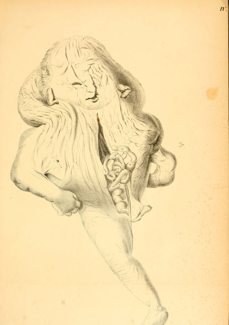 ^i-ö •X \ •% /'