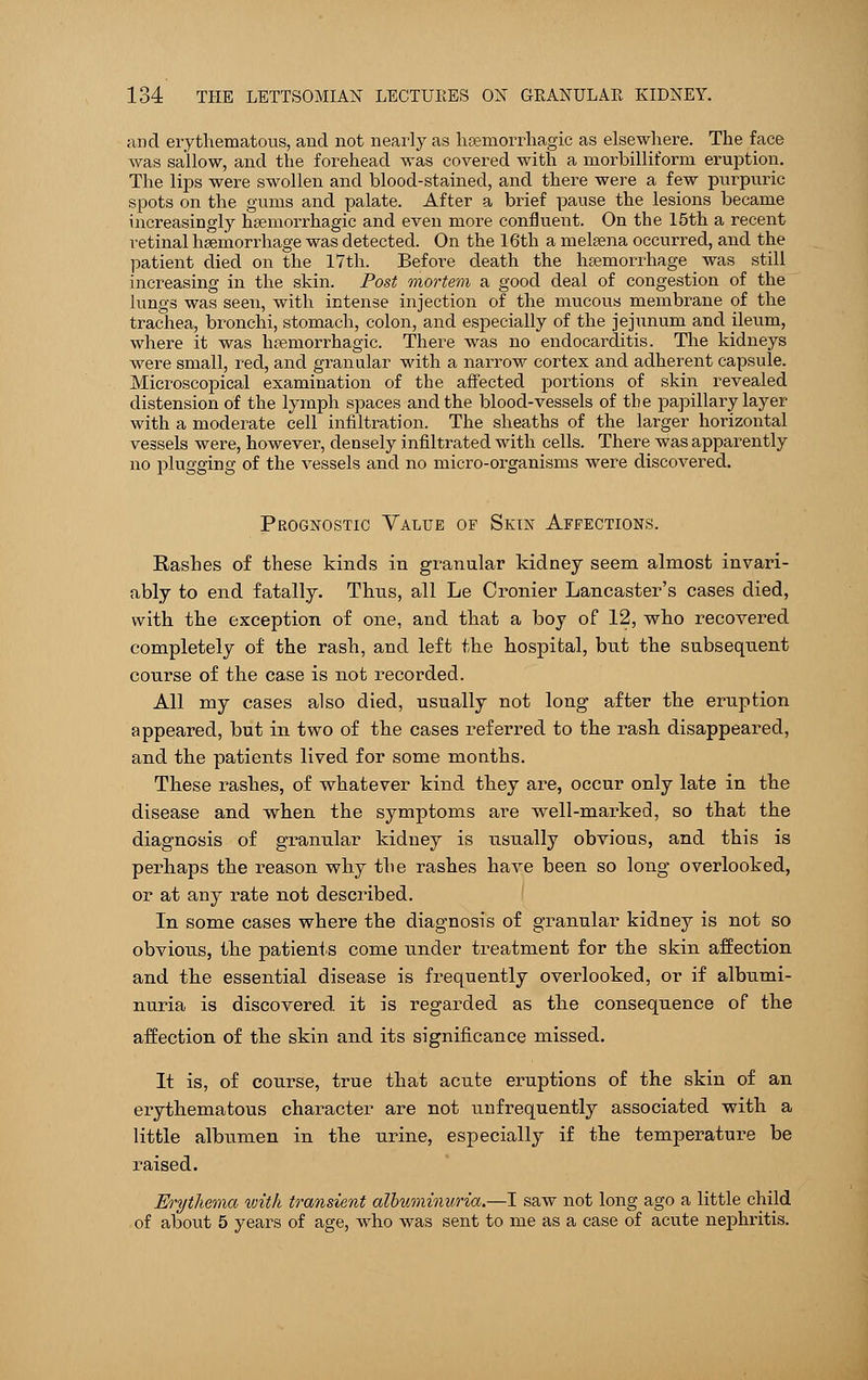 and erythematous, and not nearly as hemorrhagic as elsewhere. The face •was sallow, and the forehead was covered with a morbilliform eruption. The lips were swollen and blood-stained, and there were a few purpuric spots on the gums and palate. After a brief pause the lesions became increasingly hemorrhagic and even more confluent. On the 15th a recent retinal haemorrhage was detected. On the 16th a melsena occurred, and the patient died on the 17th. Before death the haemorrhage was still increasing in the skin. Post mortem a good deal of congestion of the lungs was seen, with intense injection of the mucous membrane of the trachea, bronchi, stomach, colon, and especially of the jejunum and ileum, where it was hemorrhagic. There was no endocarditis. The kidneys were small, red, and granular with a narrow cortex and adherent capsule. Microscopical examination of the affected portions of skin revealed distension of the lymph spaces and the blood-vessels of the papillary layer with a moderate cell infiltration. The sheaths of the larger horizontal vessels were, however, densely infiltrated with cells. There was apparently no plugging of the vessels and no micro-organisms were discovered. Prognostic Value of Skin Affections. Rashes of these kinds in granular kidney seem almost invari- ably to end fatally. Thus, all Le Cronier Lancaster's cases died, with the exception of one, and that a boy of 12, who recovered completely of the rash, and left the hospital, but the subsequent course of the case is not recorded. All my cases also died, usually not long after the eruption appeared, but in two of the cases referred to the rash disappeared, and the patients lived for some months. These rashes, of whatever kind they are, occur only late in the disease and when the symptoms are well-marked, so that the diagnosis of granular kidney is usually obvious, and this is perhaps the reason why the rashes have been so long overlooked, or at any rate not described. In some cases where the diagnosis of granular kidney is not so obvious, the patients come under treatment for the skin affection and the essential disease is frequently overlooked, or if albumi- nuria is discovered it is regarded as the consequence of the affection of the skin and its significance missed. It is, of course, true that acute eruptions of the skin of an erythematous character are not unfrequently associated with a little albumen in the urine, especially if the temperature be raised. Erythema with transient albuminuria.—I saw not long ago a little child of about 5 years of age, who was sent to me as a case of acute nephritis.