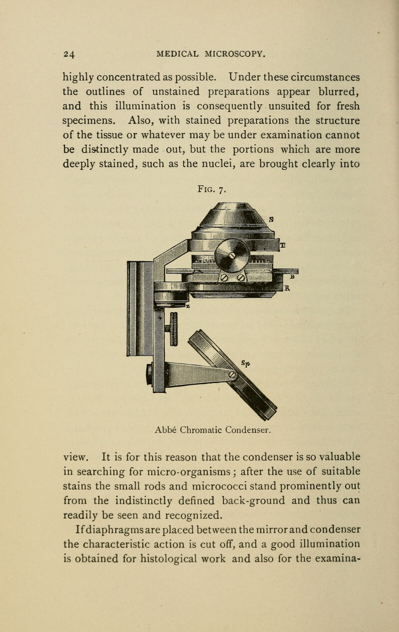 highly concentrated as possible. Under these circumstances the outlines of unstained preparations appear blurred, and this illumination is consequently unsuited for fresh specimens. Also, with stained preparations the structure of the tissue or whatever may be under examination cannot be distinctly made out, but the portions which are more deeply stained, such as the nuclei, are brought clearly into Fig. 7. Abbe Chromatic Condenser. view. It is for this reason that the condenser is so valuable in searching for micro-organisms; after the use of suitable stains the small rods and micrococci stand prominently out from the indistinctly defined back-ground and thus can readily be seen and recognized. If diaphragms are placed between the mirror and condenser the characteristic action is cut off, and a good illumination is obtained for histological work and also for the examina-