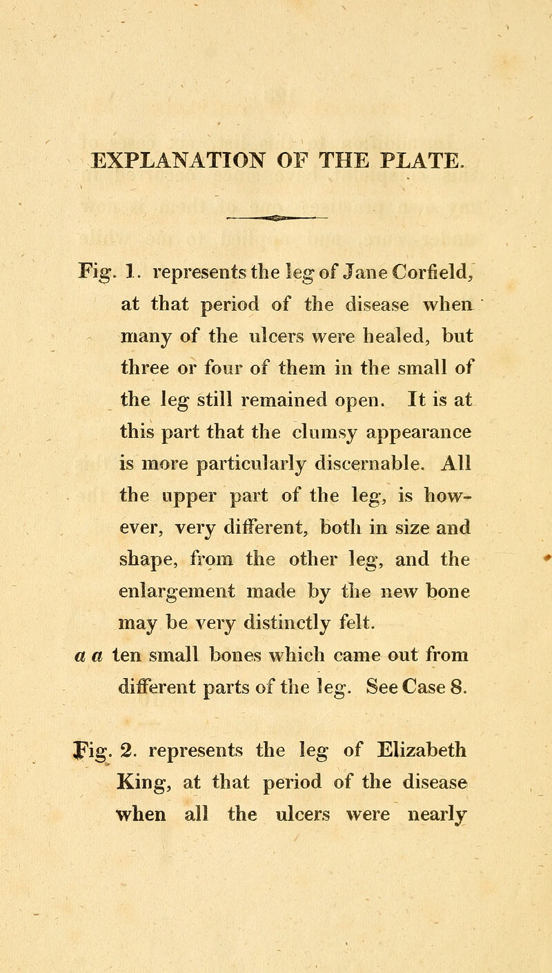 EXPLANATION OF THE PLATE, Fig. 1. represents the leg of Jane Corfield, at that period of the disease whea many of the ulcers were healed, but three or four of them in the small of the leg still remained open. It is at this part that the clumsy appearance is more particularly discernable. All the upper part of the leg, is how- ever, very diiFerent, both in size and shape, from the other leg, and the enlargement made by the new bone may be very distinctly felt. a a ten small bones which came out from different parts of the leg. See Case 8. Fig. 2. represents the leg of Elizabeth King, at that period of the disease when all the ulcers were nearly