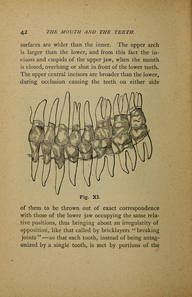 surfaces are wider than the inner. The upper arch is larger than the lower, and from this fact the in- cisors and cuspids of the upper jaw, when the mouth is closed, overhang or shut in front of the lower teeth. The upper central incisors are broader than the lower, during occlusion causing the teeth on either side Fig. XL of them to be thrown out of exact correspondence with those of the lower jaw occupying the same rela- tive positions, thus bringing about an irregularity of opposition, like that called by bricklayers breaking joints  —so that each tooth, instead of being antag- onized by a single tooth, is met by portions of the