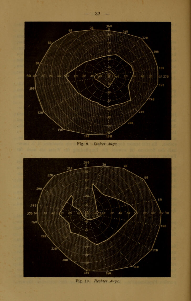 I. Ltnkes Auge. Fig. 10. Rechtes Auge.