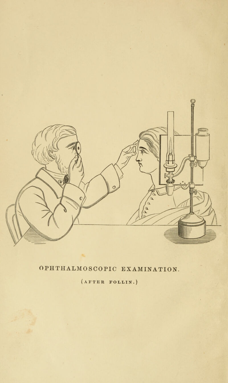 OPHTHALMOSCOPIC EXAMINATION. (after pollin.)