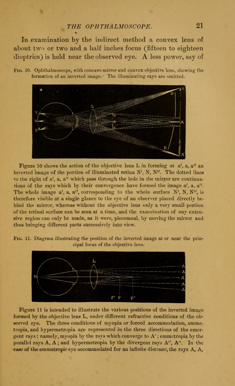 In examination by the indirect method a convex lens of about two or two and a half inches focus (fifteen to eighteen dioptrics) is held near the observed eye. A less power, say of Fig. 10. Ophthalmoscope, with concave mirror and convex objective lens, showing the formation of an inverted image.- The illuminating rays are omitted. Figure 10 shows the action of the objective lens L in forming at a', a, a an inverted image of the portion of illuminated retina W, N, N. The dotted lines to the right of a', a, a which pass through the hole in the mirror are continua- tions of the rays which by their convergence have formed the image a', a, a. The whole image a', a, a, corresponding to the whole surface N', N, N, is therefore visible at a single glance to the eye of an observer placed directly be- hind the mirror, whereas without the objective lens only a very small portion of the retinal surface can be seen at a time, and the examination of any exten- sive region can only be made, as it were, piecemeal, by moving the mirror and thus bringing different parts successively into view. Fig. 11. Diagram illustrating the position of the inverted image at or near the prin- cipal focus of the objective lens. Figure 11 is intended to illustrate the various positions of the inverted image formed by the objective lens L, under different refractive conditions of the ob- served eye. The three conditions of myopia or forced accommodation, emme- tropia, and hypermetropia are represented in the three directions of the emer- gent rays : namely, myopia by the rays which converge to A'; emmetropia by the parallel rays A, A; and hypermetropia by the divergent rays A, A. In the case of the emmetropic eye accommodated for an infinite distance, the rays A, A.,