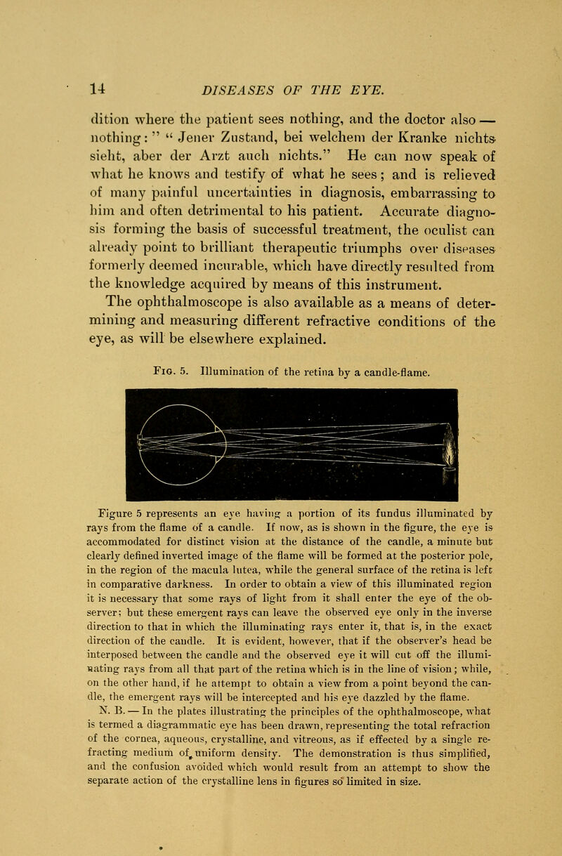 dition where the patient sees nothing, and the doctor also — nothing: Jener Zustand, bei welchem der Kranke nichts- sieht, aber der Arzt audi nichts. He can now speak of what he knows and testify of what he sees; and is relieved of many painful uncertainties in diagnosis, embarrassing to him and often detrimental to his patient. Accurate diagno- sis forming the basis of successful treatment, the oculist can already point to brilliant therapeutic triumphs over diseases formerly deemed incurable, which have directly resulted from the knowledge acquired by means of this instrument. The ophthalmoscope is also available as a means of deter- mining and measuring different refractive conditions of the eye, as will be elsewhere explained. Fig. 5. Illumination of the retina by a candle-flame. Figure 5 represents an eye having a portion of its fundus illuminated by rays from the flame of a candle. If now, as is shown in the figure, the eye is accommodated for distinct vision at the distance of the candle, a minute but clearty defined inverted image of the flame will be formed at the posterior pole, in the region of the macula lutea, while the general surface of the retina is left in comparative darkness. In order to obtain a view of this illuminated region it is necessary that some rays of light from it shall enter the eye of the ob- server; but these emergent rays can leave the observed eye only in the inverse direction to that in which the illuminating rays enter it, that is, in the exact direction of the caudle. It is evident, however, that if the observer's head be interposed between the candle and the observed eye it will cut off the illumi- nating rays from all that part of the retina which is in the line of vision; while, on the other hand, if he attempt to obtain a view from a point beyond the can- dle, the emergent rays will be intercepted and his eye dazzled by the flame. N. B. — In the plates illustrating the principles of the ophthalmoscope, what is termed a diagrammatic eye has been drawn, representing the total refraction of the cornea, aqueous, crystalline, and vitreous, as if effected by a single re- fracting medium of,.uniform density. The demonstration is thus simplified, and the confusion avoided which would result from an attempt to show the separate action of the crystalline lens in figures so limited in size.