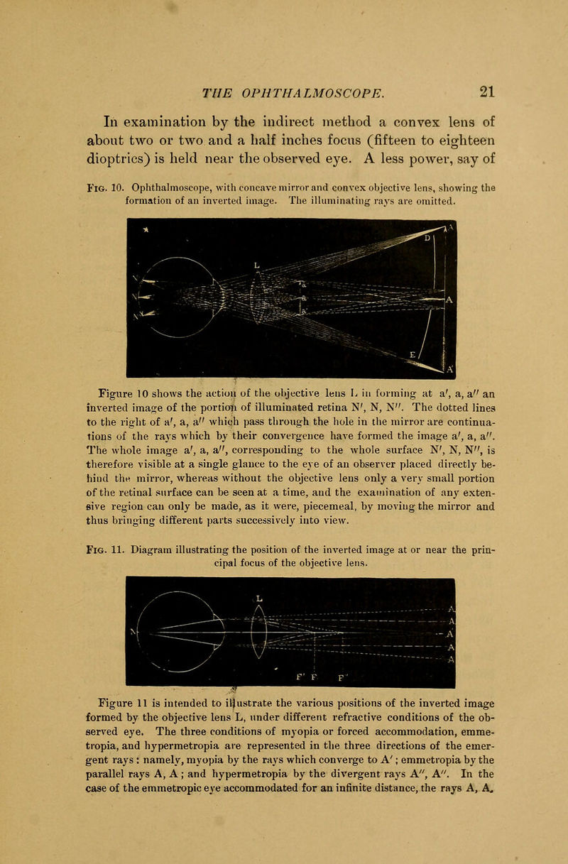 In examination by the indirect method a convex lens of about two or two and a half inches focus (fifteen to eighteen dioptrics) is held near the observed eye. A less power, say of Fig. 10. Ophthalmoscope, with concave mirror and convex objective lens, showing the formation of an inverted image. The illuminating rays are omitted. Figure 10 shows the action of the objective lens L in forming at a', a, a an inverted image of the portion of illuminated retina N', N, N. The dotted lines to the right of a', a, a which pass through the hole in the mirror are continua- tions of the rays which by their convergence have formed the image a', a, a. The whole image a', a, a, corresponding to the whole surface N', N, N, is therefore visible at a single glance to the eye of an observer placed directly be- hind the mirror, whereas without the objective lens only a very small portion of the retinal surface can be seen at a time, and the examination of any exten- sive region can only be made, as it were, piecemeal, by moving the mirror and thus bringing different parts successively into view. Fig. 11. Diagram illustrating the position of the inverted image at or near the prin- cipal focus of the objective lens. Figure 11 is intended to illustrate the various positions of the inverted image formed by the objective lens L, under different refractive conditions of the ob- served eye. The three conditions of myopia or forced accommodation, emme- tropia, and hypermetropia are represented in the three directions of the emer- gent rays : namely, myopia by the rays which converge to A'; emmetropia by the parallel rays A, A; and hypermetropia by the divergent rays A, A. In the case of the emmetropic eye accommodated for an infinite distance, the rays A, A„