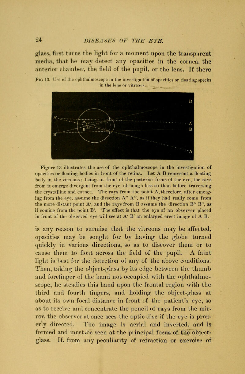 glass, first turns the light for a moment upon the transparent media, that he may detect any opacities in the cornea, the anterior chamber, the field of the pupil, or the lens. If there Fig 13. Use of the ophthalmoscope in the investigation of opacities or floating specks in the lens or vitreous. Figure 13 illustrates the use of the ophthalmoscope in the investigation of opacities or floating bodies in front of the retina. Let A B represent a floating body in the vitreous ; being in front of the posterior focus of the eve, the rays from it emerge divergent from the eye, although less so than before traversing the crystalline and cornea. The rays from the point A, therefore, after emerg- ing from the eve, assume the direction A A, as if they had really come from the more distant point A', and the rays from B assume the direction B B, as if coming from the point B'. The effect is that the eye of an observer placed in front of the observed eye will see at A' B' an enlarged erect image of A B. is any reason to surmise that the vitreous may be affected, opacities may be sought for by having the globe turned quickly in various directions, so as to discover them or to cause them to float across the field of the pupil. A faint light is best for the detection of any of the above conditions. Then, taking the object-glass by its edge between the thumb and forefinger of the hand not occupied with the ophthalmo- scope, he steadies this hand upon the frontal region with the third and fourth fingers, and holding the object-glass at about its own focal distance in front of the patient's eye, so as to receive and concentrate the pencil of rays from the mir- ror, the observer at once sees the optic disc if the eye is prop- erly directed. The image is aerial and inverted, and is formed and musUbe seen at the principal focus of the object- glass. If, from any peculiarity of refraction or exercise of