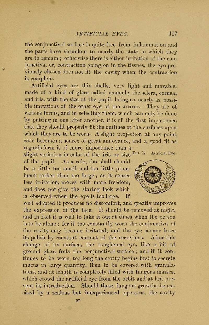 the conjunctival surface is quite free from inflammation and the parts have shrunken to nearly the state in which they are to remain ; otherwise there is either irritation of the con- junctiva, or, contraction going on in the tissues, the eye pre- viously chosen does not fit the cavity when the contraction is complete. Artificial eyes are thin shells, very light and movable, made of a kind of glass called enamel; the sclera, cornea, and iris, with the size of the pupil, being as nearly as possi- ble imitations of the other eye of the wearer. They are of various forms, and in selecting them, which can only be done by putting in one after another, it is of the first importance that they should properly fit the outlines of the surfaces upon which they are to be worn. A slight projection at any point soon becomes a source of great annoyance, and a good fit as regards form is of more importance than a slight variation in color of the iris or size FlG 37- Artlficial Eye- of the pupil. As a rule, the shell should be a little too small and too little prom- inent rather than too large ; as it causes less irritation, moves with more freedom, and does not give the staring look which is observed when the eye is too large. If well adapted it produces no discomfort, and greatly improves the expression of the face. It should be removed at night, and in fact it is well to take it out at times when the person is to be alone ; for if too constantly worn the conjunctiva of the cavity may become irritated, and the eye sooner loses its polish by constant contact of the secretions. After this change of its surface, the roughened eye, like a bit of ground glass, frets the conjunctival surface ; and if it con- tinues to be worn too long the cavity begins first to secrete mucus in large quantity, then to be covered with granula- tions, and at length is completely filled with fungous masses, which crowd the artificial eye from the orbit and at last pre- vent its introduction. Should these fungous growths be ex- cised by a zealous but inexperienced operator, the cavity
