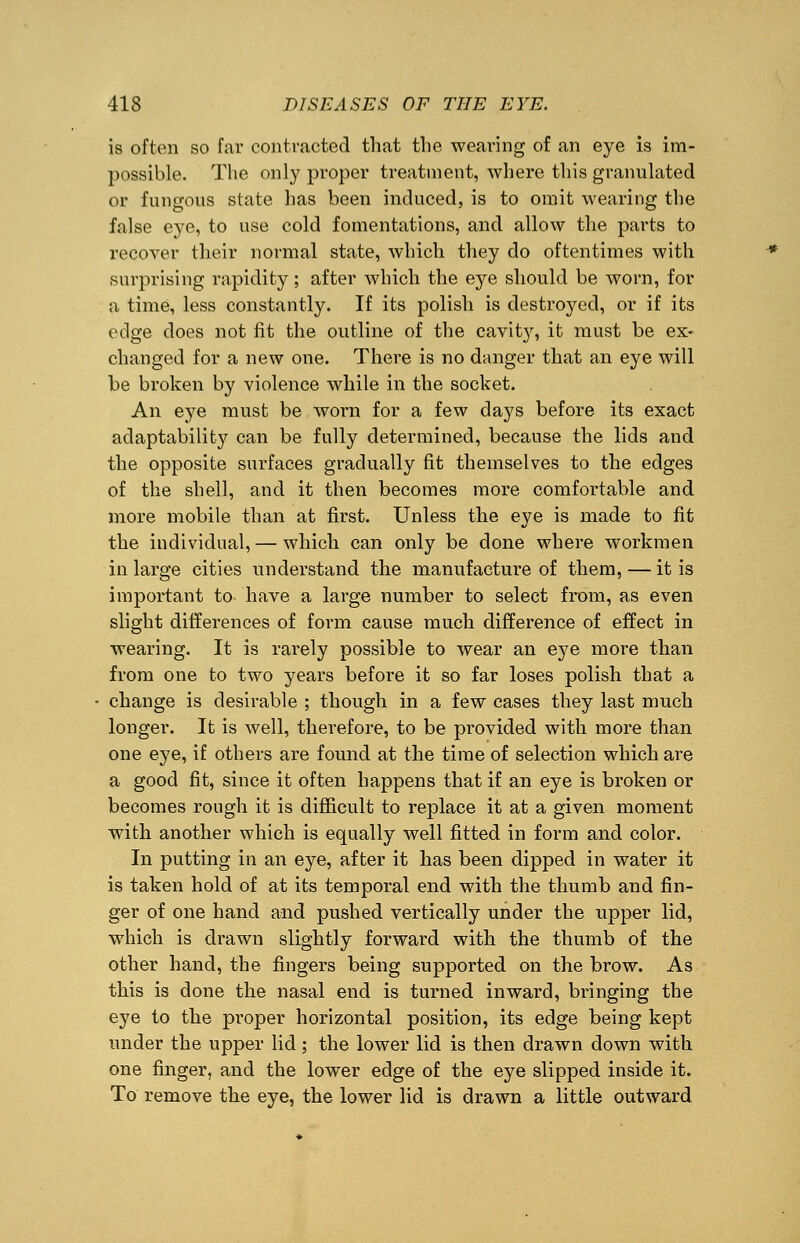 is often so far contracted that the wearing of an eye is im- possible. The only proper treatment, where this granulated or fungous state has been induced, is to omit wearing the false eye, to use cold fomentations, and allow the parts to recover their normal state, which they do oftentimes with surprising rapidity; after which the eye should be worn, for a time, less constantly. If its polish is destroyed, or if its edge does not fit the outline of the cavit}', it must be ex- changed for a new one. There is no danger that an eye will be broken by violence while in the socket. An eye must be worn for a few days before its exact adaptability can be fully determined, because the lids and the opposite surfaces gradually fit themselves to the edges of the shell, and it then becomes more comfortable and more mobile than at first. Unless the eye is made to fit the individual, — which can only be done where workmen in large cities understand the manufacture of them, — it is important to have a large number to select from, as even slight differences of form cause much difference of effect in wearing. It is rarely possible to wear an eye more than from one to two years before it so far loses polish that a change is desirable ; though in a few cases they last much longer. It is well, therefore, to be provided with more than one eye, if others are found at the time of selection which are a good fit, since it often happens that if an eye is broken or becomes rough it is difficult to replace it at a given moment with another which is equally well fitted in form and color. In putting in an eye, after it has been dipped in water it is taken hold of at its temporal end with the thumb and fin- ger of one hand and pushed vertically under the upper lid, which is drawn slightly forward with the thumb of the other hand, the fingers being supported on the brow. As this is done the nasal end is turned inward, bringing the eye to the proper horizontal position, its edge being kept under the upper lid; the lower lid is then drawn down with one finger, and the lower edge of the eye slipped inside it. To remove the eye, the lower lid is drawn a little outward