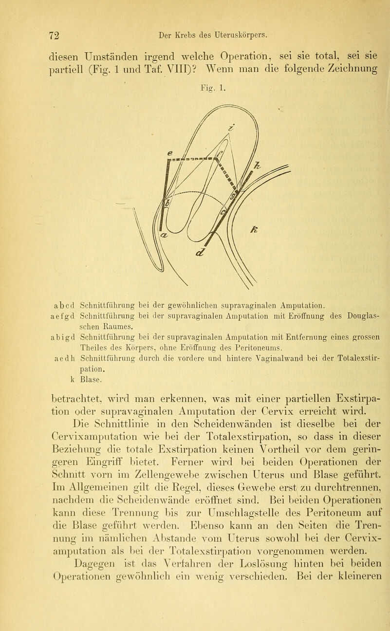 diesen Umständen irgend welche Operation, sei sie total, sei sie partiell (Fig. 1 und Taf. VIII)? Wenn man die folgende Zeichnung Fig. 1. ab cd Schnittführung bei der gewöhnlichen supravaginalen Amputation, aefgd Schnittführung bei der supravaginalen Amputation mit Eröffnung des Douglas- schen Raumes, abigd Schnittführung bei der supravaginalen Amputation mit Entfernung eines grossen Theiles des Körpers, ohne Eröffnung des Peritoneums, aedh Schnittführung durch die vordere und hintere Vaginalwand bei der Totalexstir- pation. k Blase. betrachtet, wird man erkennen, was mit einer partiellen Exstirpa- tion oder supravaginalen Amputation der Oervix erreicht wird. Die Schnittlinie in den Scheidenwänden ist dieselbe bei der Cervixamputation wie bei der Totalexstirpation, so dass in dieser Beziehung die totale Exstirpation keinen Vortheil vor dem gerin- geren Eingriff bietet. Ferner wird bei beiden Operationen der Schnitt vorn im Zellengewebe zwischen Uterus und Blase geführt. Im Allgemeinen gilt die Regel, dieses Gewebe erst zu durchtrennen, nachdem die Scheiclenwände eröffnet sind. Bei beiden Operationen kann diese Trennung bis zur Umschlagstelle des Peritoneum auf die Blase geführt werden. Ebenso kann an den Seiten die Tren- nung im nämlichen Abstände vom Uterus sowohl bei der Cervix- amputation als bei der Totalexstirpation vorgenommen werden. Dagegen ist das Verfahren der Loslösung hinten bei beiden Operationen gewöhnlich ein wenig verschieden. Bei der kleineren