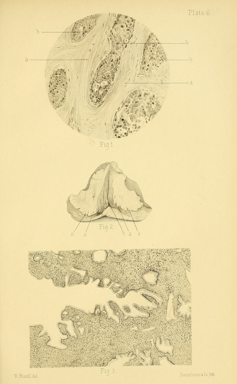**&& — > I 1 4 /'■ V r ' *'! 7 -> , ! fr M l{ ;-•- v, / TS ' i> A * o ( »■ '•' 'Q / . • I ' iü» ° ' ■ -.* Plate 6. : Fl3- -/■■ £t ür m / I FlcJx \\ a a b a a ;■:/■ ^r-'A' J vv;: f\ h. 'Mi S i $ R.Boxall.del. Fig. 3 DaraelssouiCi.litli
