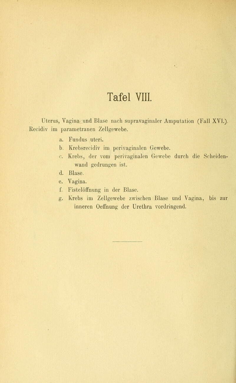 Uterus, Vagina- und Blase nach supravaginaler Amputation (Fall XVI.). Recidiv im parametranen Zellgewebe. a. Fundus uteri. b. Krebsrecidiv im perivaginalen Gewebe. c. Krebs, der vom peri vaginalen Gewebe durch die Scheiden- wand gedrungen ist. d. Blase. e. Vagina. f. Fistelöffnung in der Blase. g. Krebs im Zellgewebe zwischen Blase und Vagina, bis zur inneren Oeffnung der Urethra vordringend.