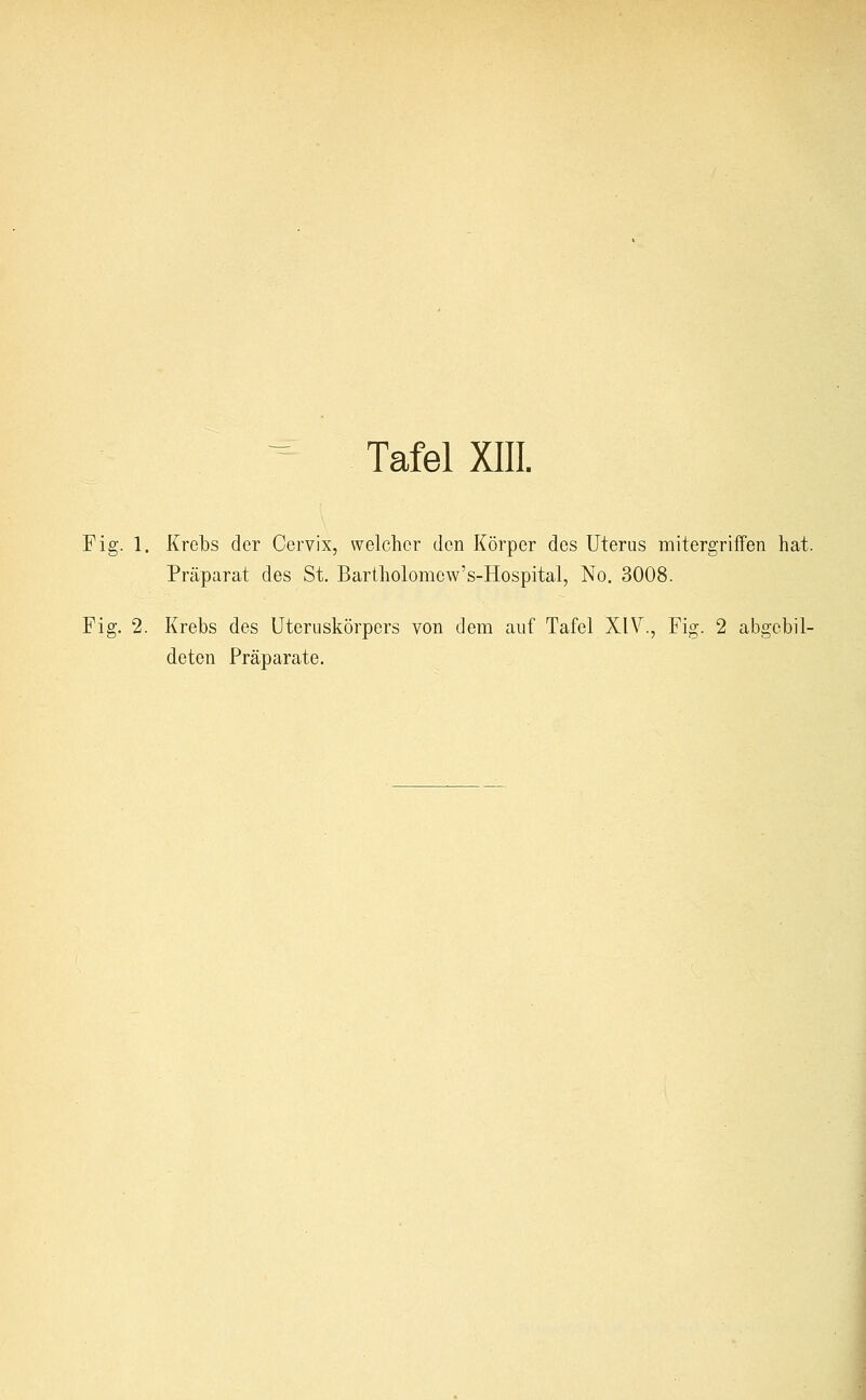 Fig. 1. Krebs der Cervix, welcher den Körper des Uterus mitergriffen hat. Präparat des St. Bartholomew's-Hospital, No. 3008. Fig. 2. Krebs des Uteruskörpers von dem auf Tafel XIV., Fig. 2 abgebil- deten Präparate.