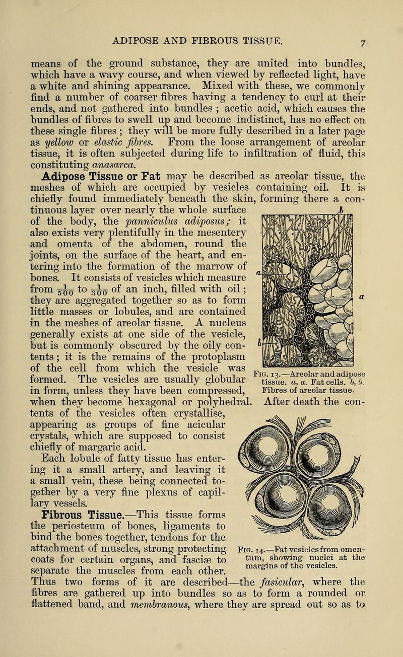 ADIPOSE AND FIBROUS TISSUE. means of the ground substance, they are united into bundles, which have a wavy course, and when viewed by reflected light, have a white and shining appearance. Mixed with these, we commonly find a number of coarser fibres having a tendency to curl at their ends, and not gathered into bundles ; acetic acid, which causes the bundles of fibres to swell up and become indistinct, has no effect on these single fibres ; they will be more fully described in a later page as yellow or elastic fibres. From the loose arrangement of areolar tissue, it is often subjected during life to infiltration of fluid, this constituting anasarca. Adipose Tissue or Fat may be described as areolar tissue, the meshes of which are occupied by vesicles containing oil. It is chiefly found immediately beneath the skin, forming there a con- tinuous layer over nearly the whole surface of the body, the panniculus adiposus; it also exists very plentifully in the mesentery and omenta of the abdomen, round the joints, on the surface of the heart, and en- tering into the formation of the marrow of bones. It consists of vesicles which measure from 5^q to jj^q of an inch, filled with oil; they are aggregated together so as to form little masses or lobules, and are contained in the meshes of areolar tissue. A nucleus generally exists at one side of the vesicle, but is commonly obscured by the oily con- tents ; it is the remains of the protoplasm of the cell from which the vesicle was formed. The vesicles are usually globular in form, unless they have been compressed, when they become hexagonal or polyhedral, tents of the vesicles often crystallise, appearing as groups of fine acicular crystals, which are supposed to consist chiefly of margaric acid. Each lobule of fatty tissue has enter- ing it a small artery, and leaving it a small vein, these being connected to- gether by a very fine plexus of capil- lary vessels. Fibrous Tissue.—This tissue forms the periosteum of bones, ligaments to bind the bones together, tendons for the attachment of muscles, strong protecting coats for certain organs, and fascia? to separate the muscles from each other. Thus two forms of it are described—the fasicular, where the fibres are gathered up into bundles so as to form a rounded or flattened band, and membranous, where they are spread out so as to Fig. 13.—Areolar and adipose tissue, a, a. Fat cells, b, (>. Fibres of areolar tissue. After death the con- Fig. 14.—Fat vesicles from omen- tum, showing nuclei at the margins of the vesicles.