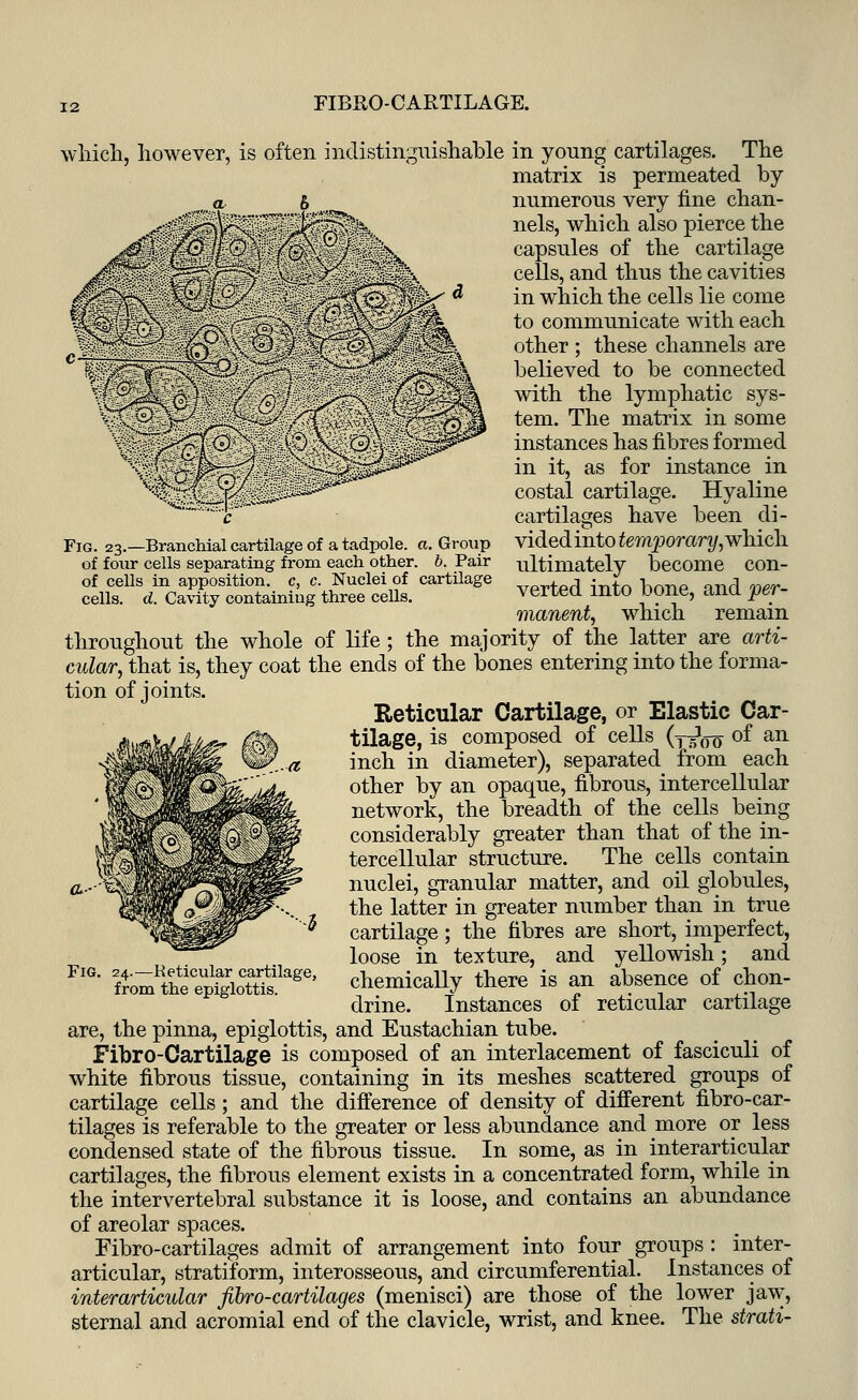 FIBRO-CARTILAGE. ei^fk Fig. 23.—Branchial cartilage of a tadpole, a. Group of four cells separating from each other, b. Pair of cells in apposition, c, c. Nuclei of cartilage cells, d. Cavity containing three cells. which, however, is often indistinguishable in young cartilages. The matrix is permeated by h _ numerous very fine chan- nels, which also pierce the capsules of the cartilage cells, and thus the cavities in which the cells lie come to communicate with each other ; these channels are believed to be connected with the lymphatic sys- tem. The matrix in some instances has fibres formed in it, as for instance in costal cartilage. Hyaline cartilages have been di- vided into temporary, which ultimately become con- verted into bone, and per- manent, which remain throughout the whole of life ; the majority of the latter are arti- cular, that is, they coat the ends of the bones entering into the forma- tion of joints. Reticular Cartilage, or Elastic Car- tilage, is composed of cells (y^oo °f aR inch in diameter), separated from each other by an opaque, fibrous, intercellular network, the breadth of the cells being considerably greater than that of the in- tercellular structure. The cells contain nuclei, granular matter, and oil globules, the latter in greater number than in true cartilage; the fibres are short, imperfect, loose in texture, and yellowish; and chemically there is an absence of chon- drine. Instances of reticular cartilage are, the pinna, epiglottis, and Eustachian tube. Fibre-Cartilage is composed of an interlacement of fasciculi of white fibrous tissue, containing in its meshes scattered groups of cartilage cells; and the difference of density of different fibro-car- tilages is referable to the greater or less abundance and more or less condensed state of the fibrous tissue. In some, as in interarticular cartilages, the fibrous element exists in a concentrated form, while in the intervertebral substance it is loose, and contains an abundance of areolar spaces. Fibro-cartilages admit of arrangement into four groups : inter- articular, stratiform, interosseous, and circumferential. Instances of interarticular fibro-cartilages (menisci) are those of the lower jaw, sternal and acromial end of the clavicle, wrist, and knee. The strati- 24.—Reticular cartilage, from the epiglottis.