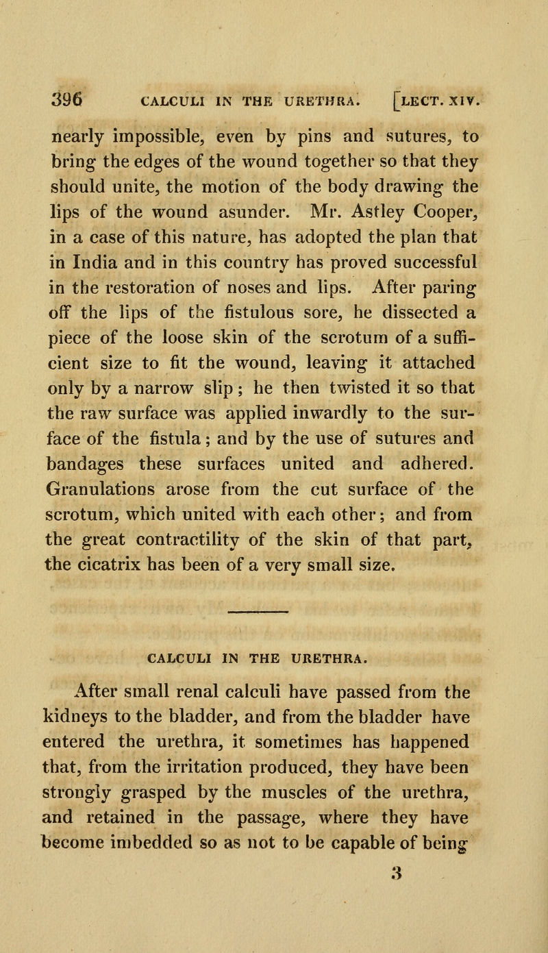nearly impossible, ev^en by pins and sutures, to bring the edges of the wound together so that they should unite, the motion of the body drawing the lips of the wound asunder. Mr. Astley Cooper, in a ease of this nature, has adopted the plan that in India and in this country has proved successful in the restoration of noses and lips. After paring off the lips of the fistulous sore, he dissected a piece of the loose skin of the scrotum of a suffi- cient size to fit the wound, leaving it attached only by a narrow slip; he then twisted it so that the raw surface was applied inwardly to the sur- face of the fistula; and by the use of sutures and bandages these surfaces united and adhered. Granulations arose from the cut surface of the scrotum, which united with each other; and from the great contractility of the skin of that part^ the cicatrix has been of a very small size. CALCULI IN THE URETHRA. After small renal calculi have passed from the kidneys to the bladder, and from the bladder have entered the urethra, it sometimes has happened that, from the irritation produced, they have been strongly grasped by the muscles of the urethra, and retained in the passage, where they have become imbedded so as not to be capable of being 3